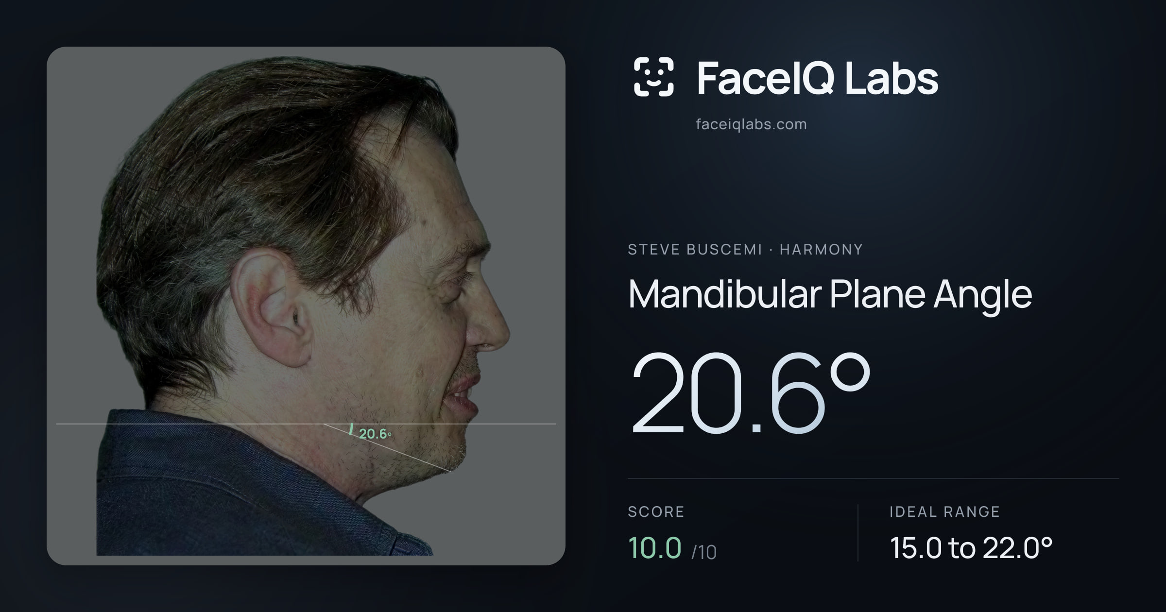 Steve Buscemi Mandibular Plane Angle: 20.6°, drawn on the photo