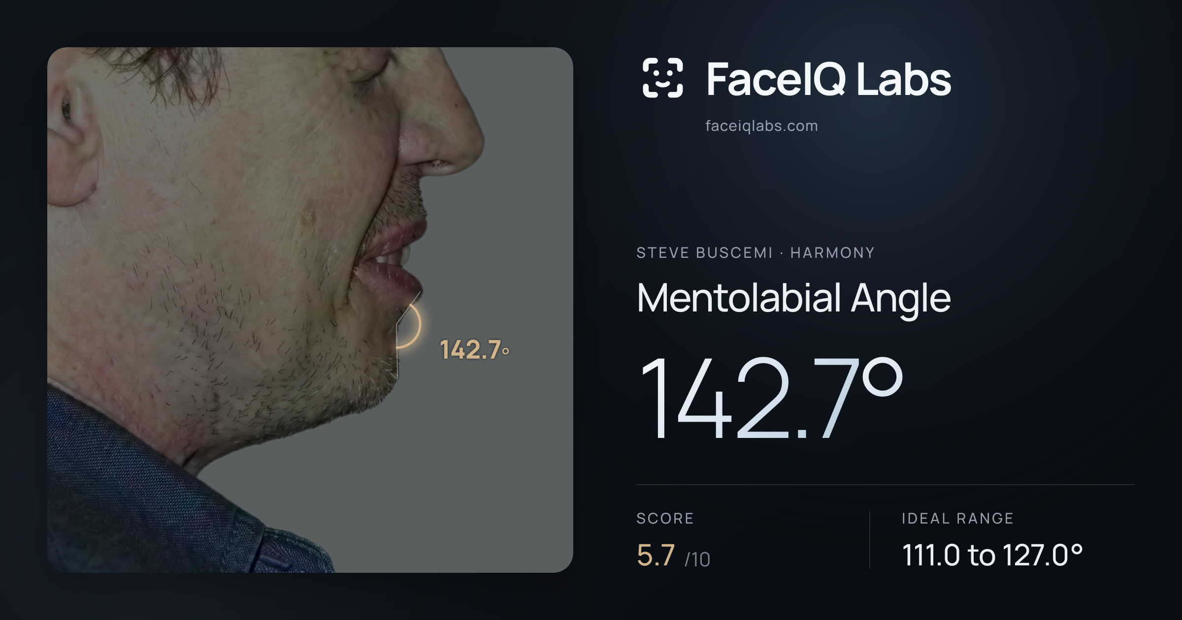 Steve Buscemi Mentolabial Angle: 142.7°, drawn on the photo