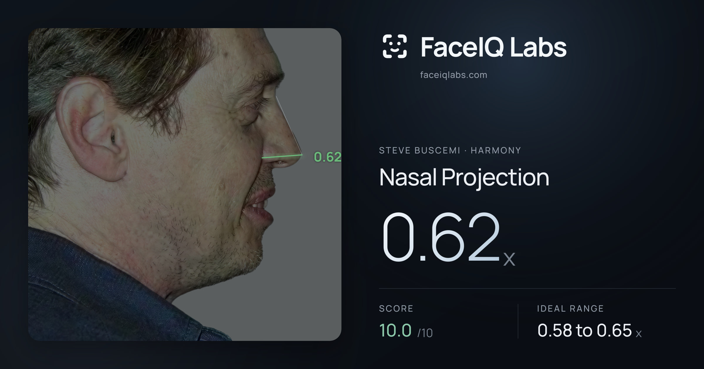 Steve Buscemi Nasal Projection: 0.62x, drawn on the photo