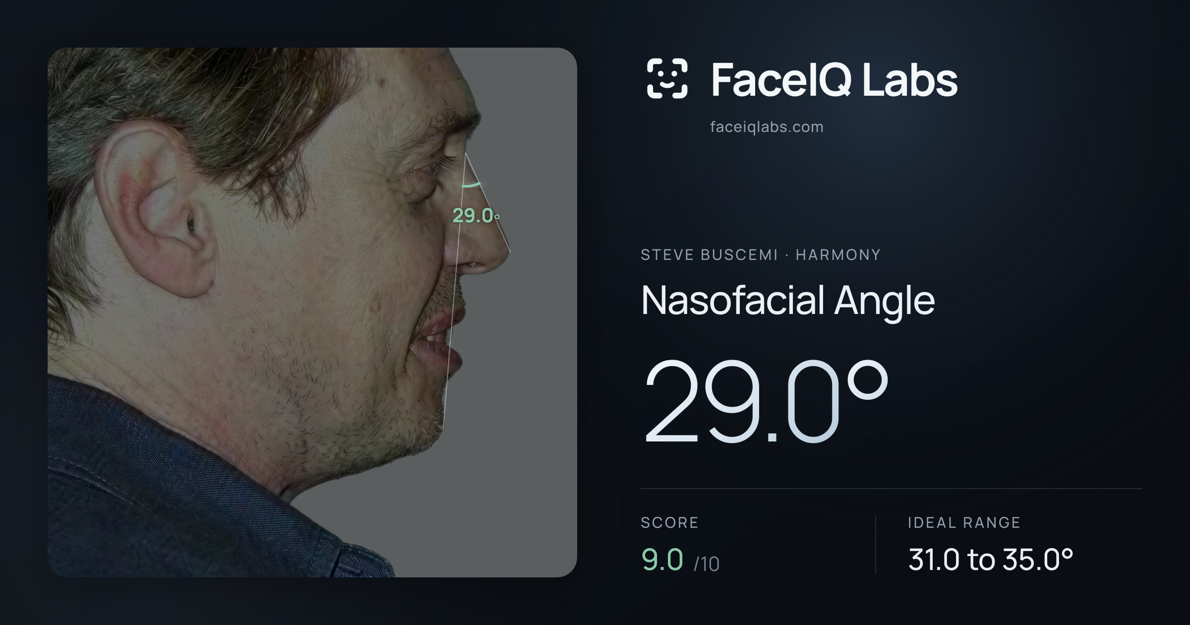 Steve Buscemi Nasofacial Angle: 29.0°, drawn on the photo