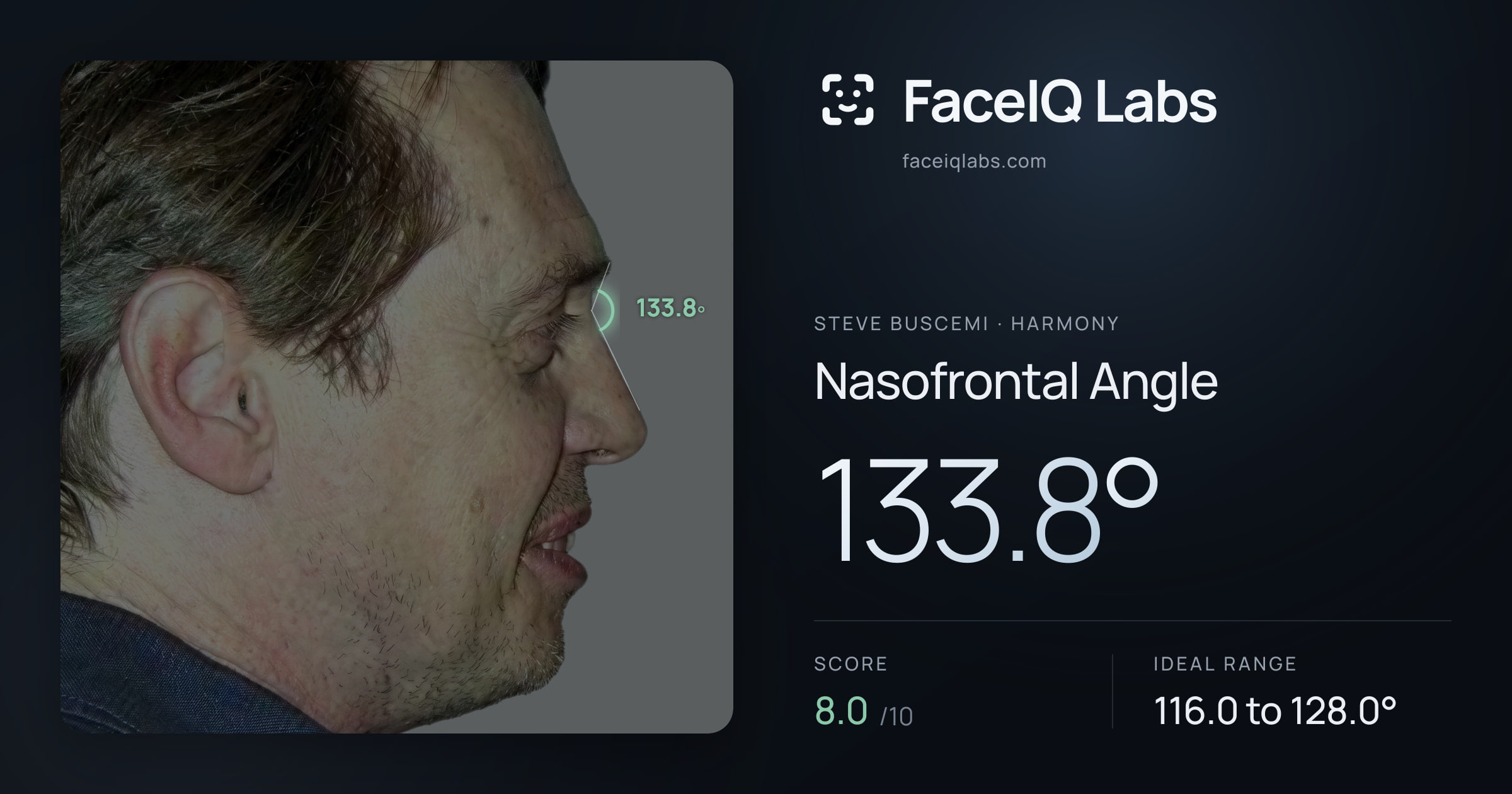 Steve Buscemi Nasofrontal Angle: 133.8°, drawn on the photo