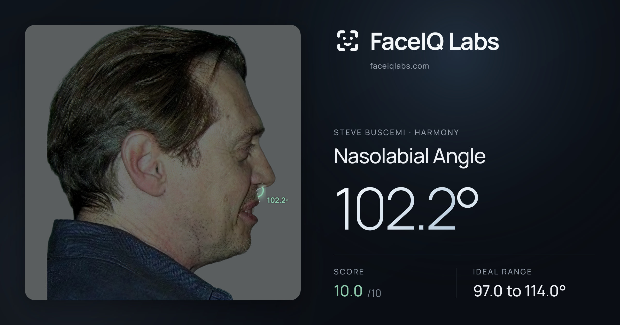 Steve Buscemi Nasolabial Angle: 102.2°, drawn on the photo
