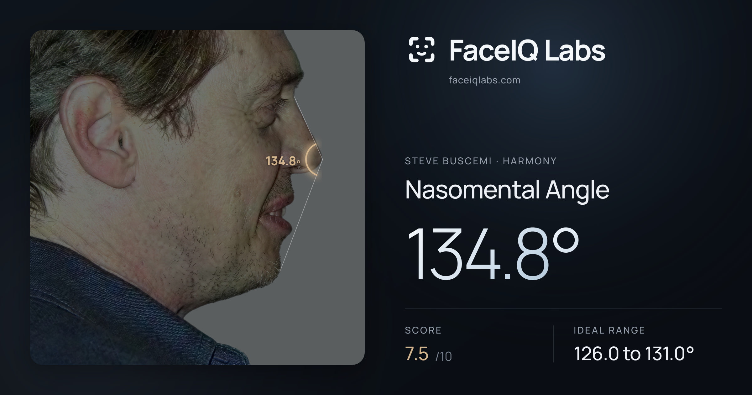 Steve Buscemi Nasomental Angle: 134.8°, drawn on the photo