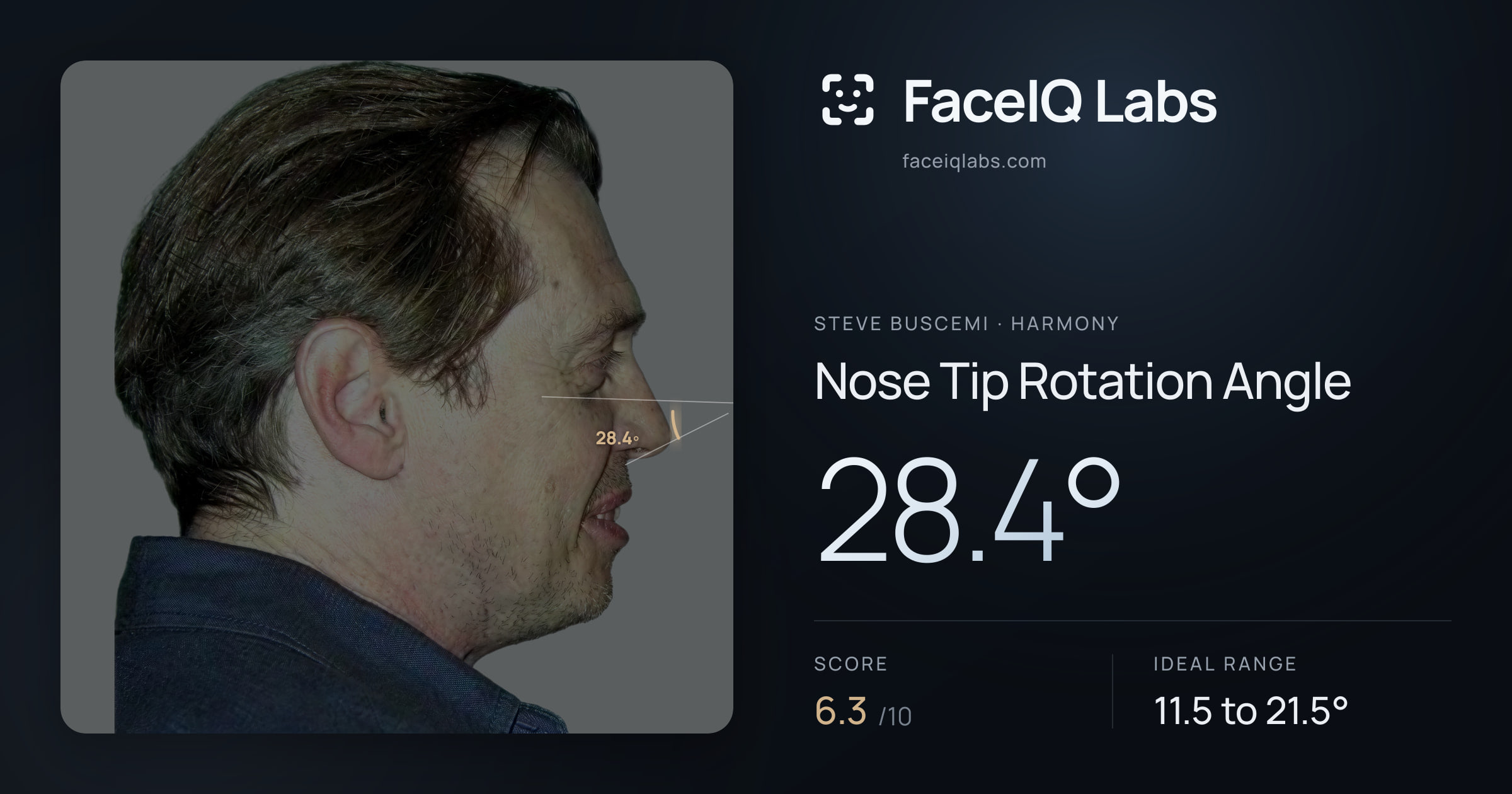 Steve Buscemi Nose Tip Rotation Angle: 28.4°, drawn on the photo