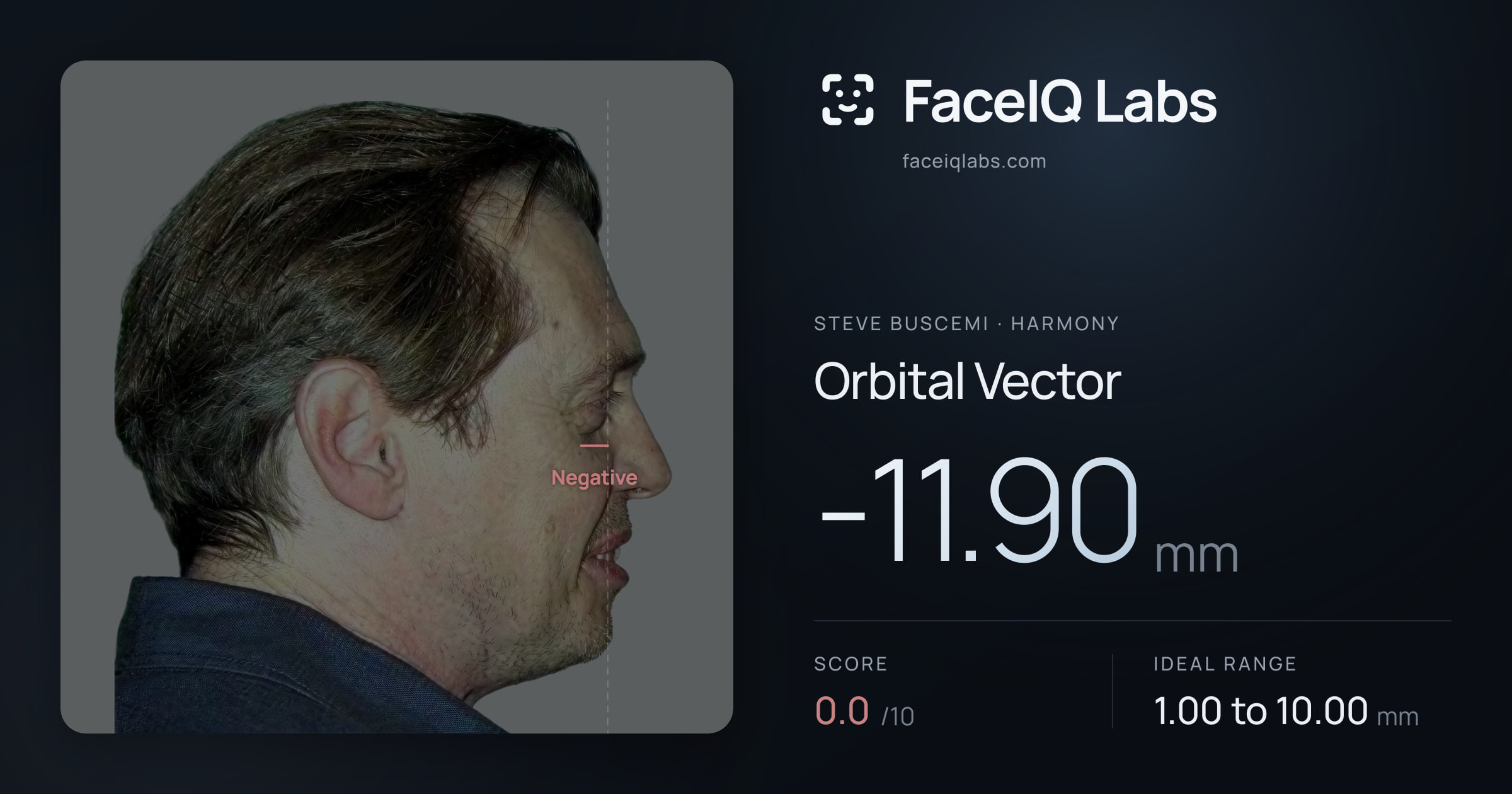 Steve Buscemi Orbital Vector: -11.90mm, drawn on the photo