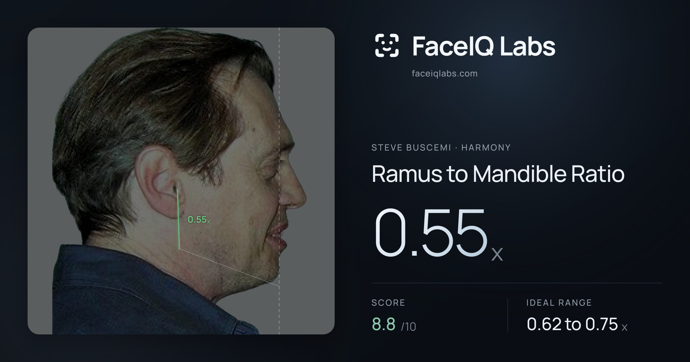 Steve Buscemi Ramus to Mandible Ratio: 0.55x, drawn on the photo