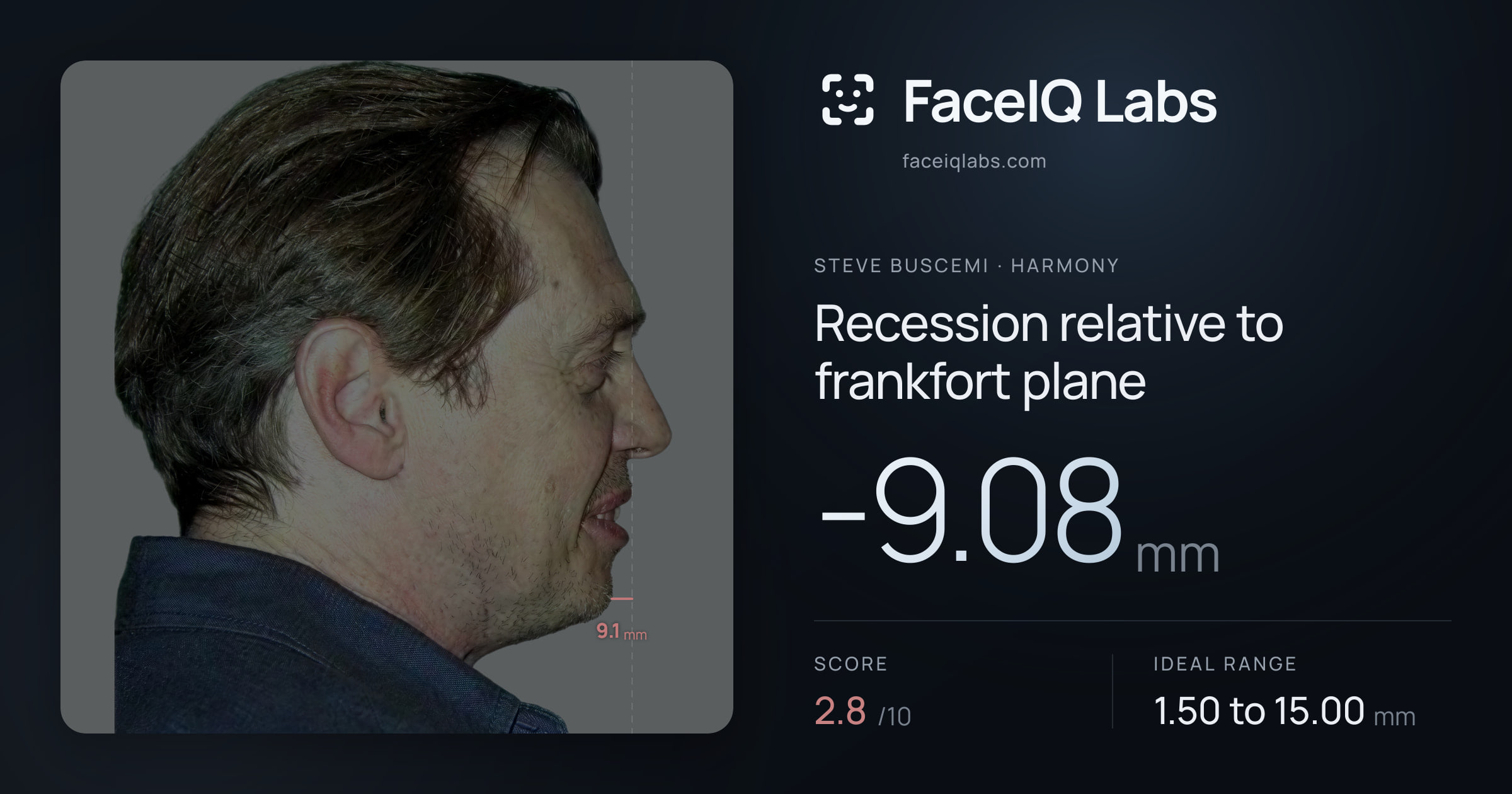 Steve Buscemi Recession relative to frankfort plane: -9.08mm, drawn on the photo