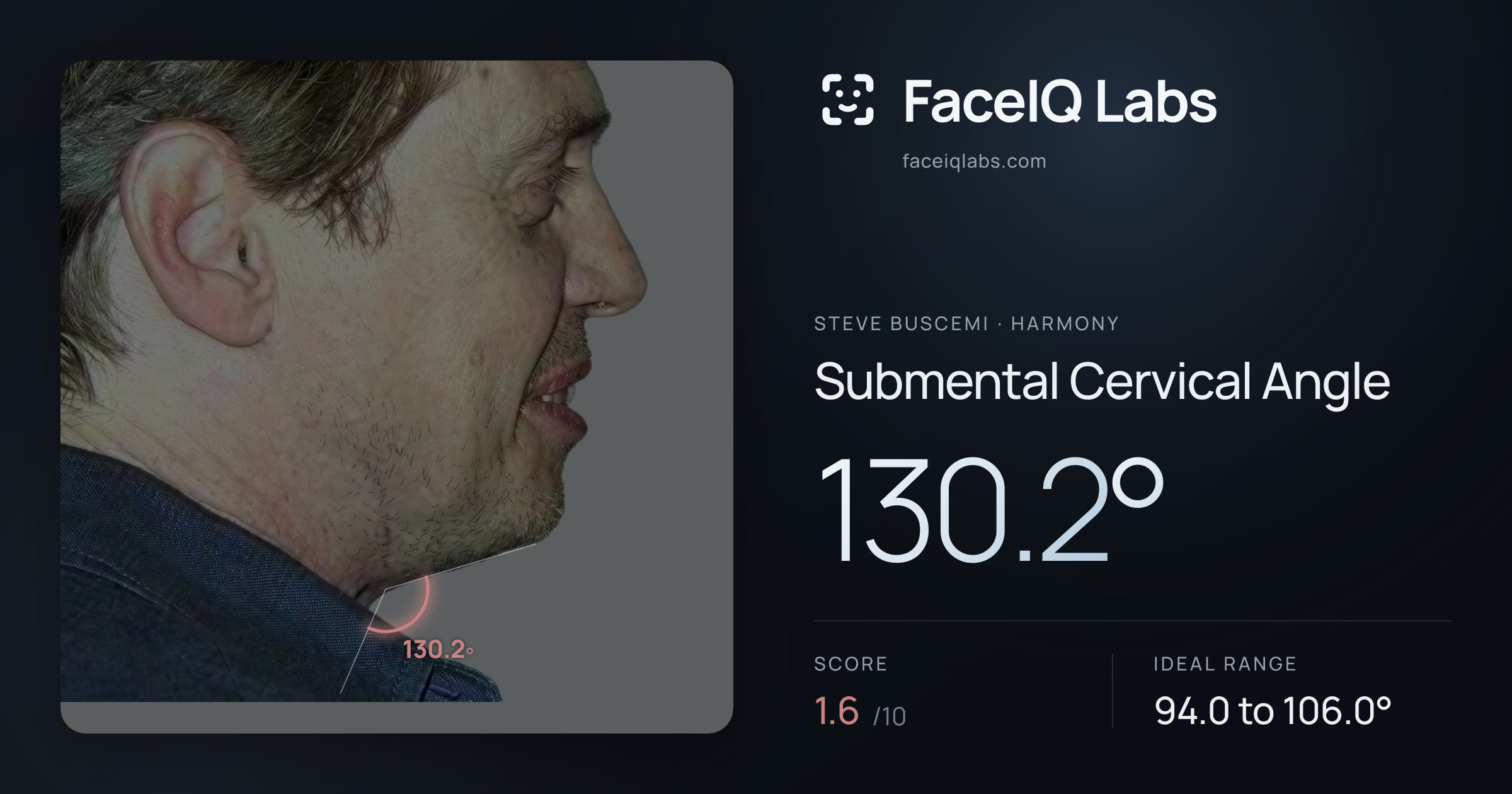 Steve Buscemi Submental Cervical Angle: 130.2°, drawn on the photo