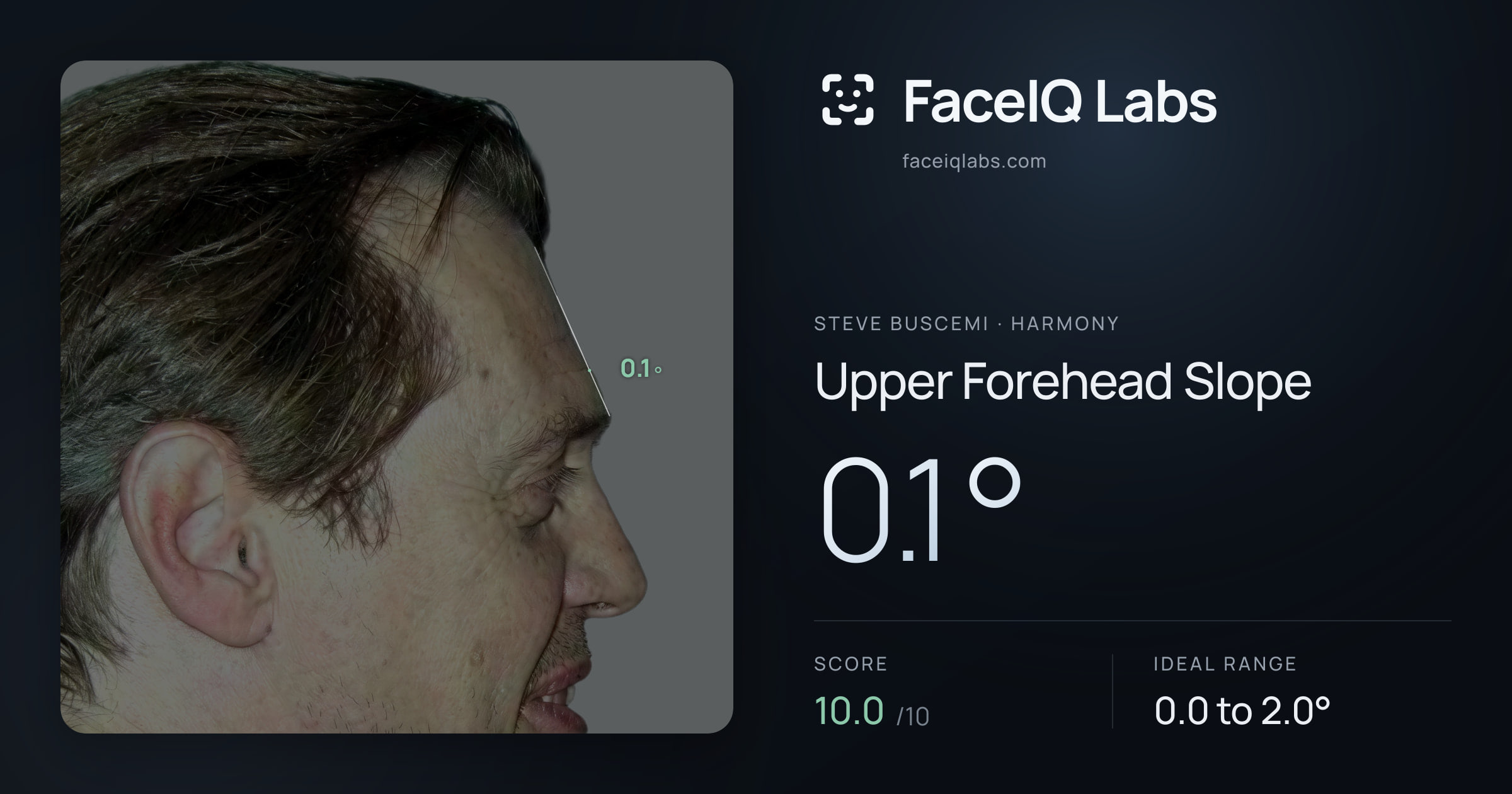 Steve Buscemi Upper Forehead Slope: 0.1°, drawn on the photo