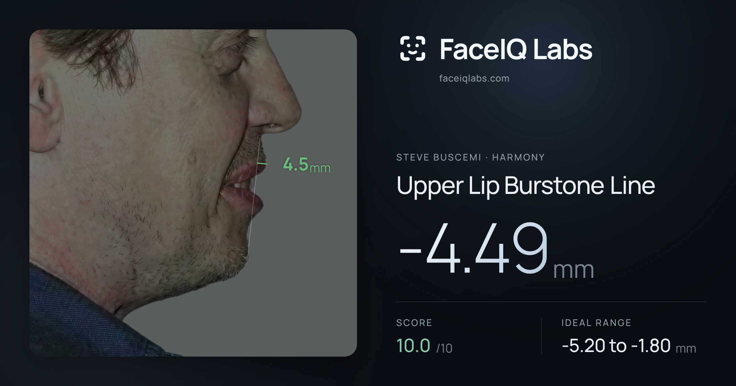 Steve Buscemi Upper Lip Burstone Line: -4.49mm, drawn on the photo