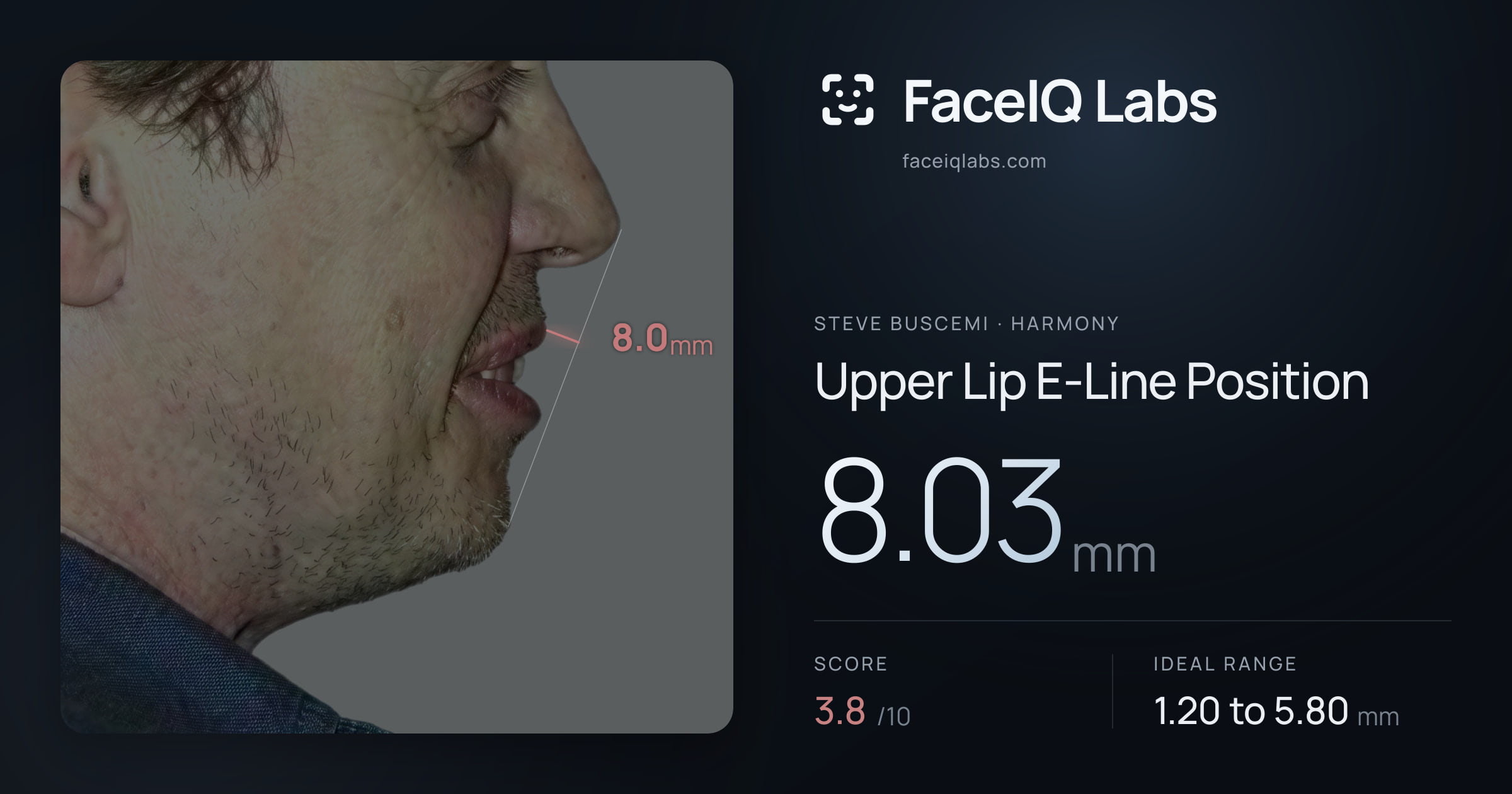Steve Buscemi Upper Lip E-Line Position: 8.03mm, drawn on the photo