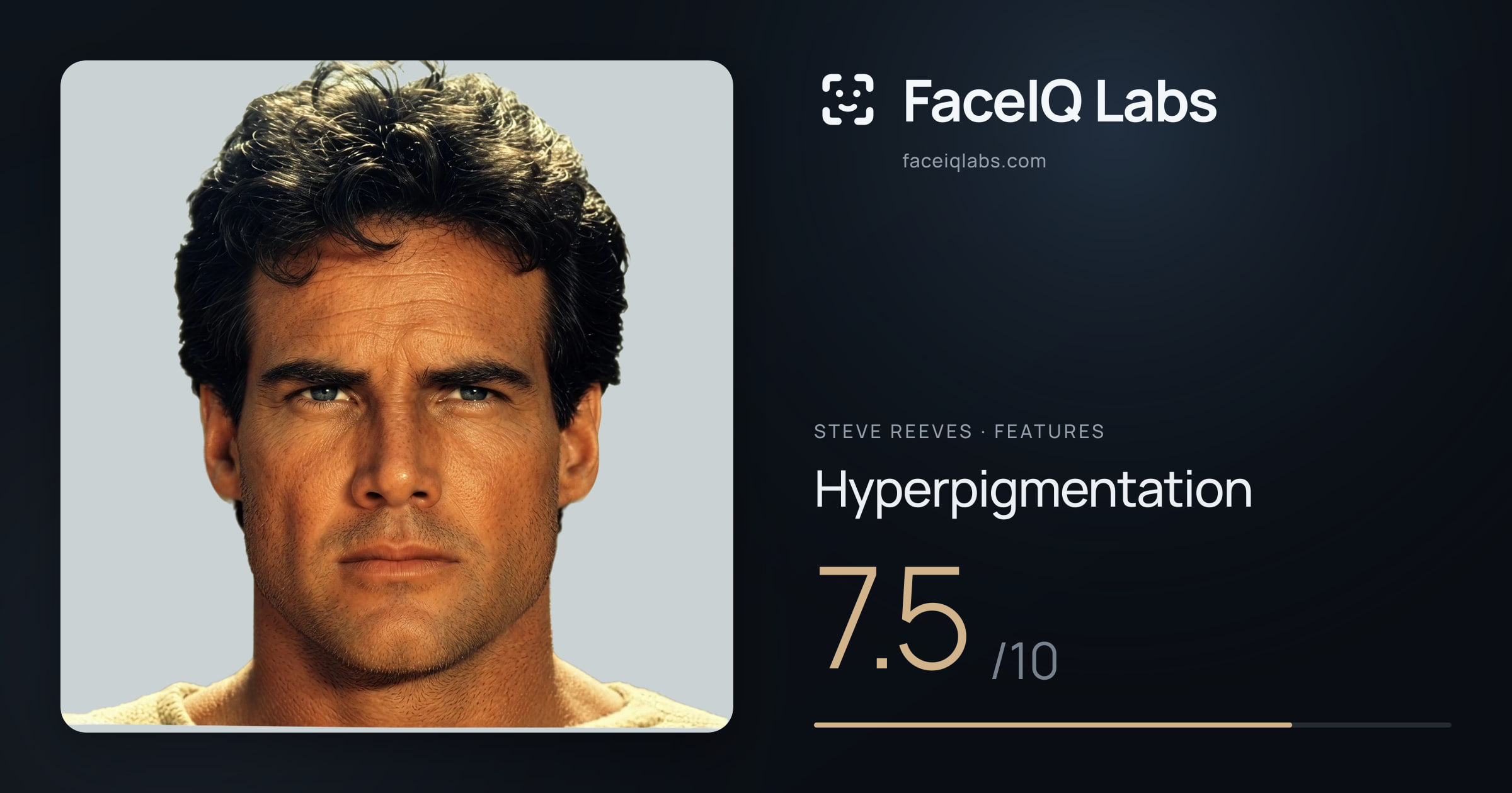 Steve Reeves Hyperpigmentation: 7.5/10, drawn on the photo