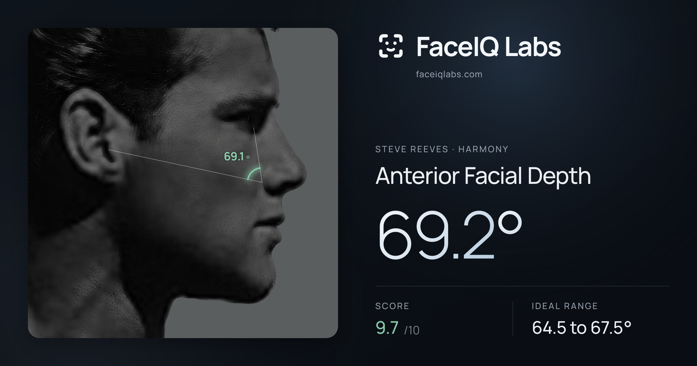 Steve Reeves Anterior Facial Depth: 69.2°, drawn on the photo