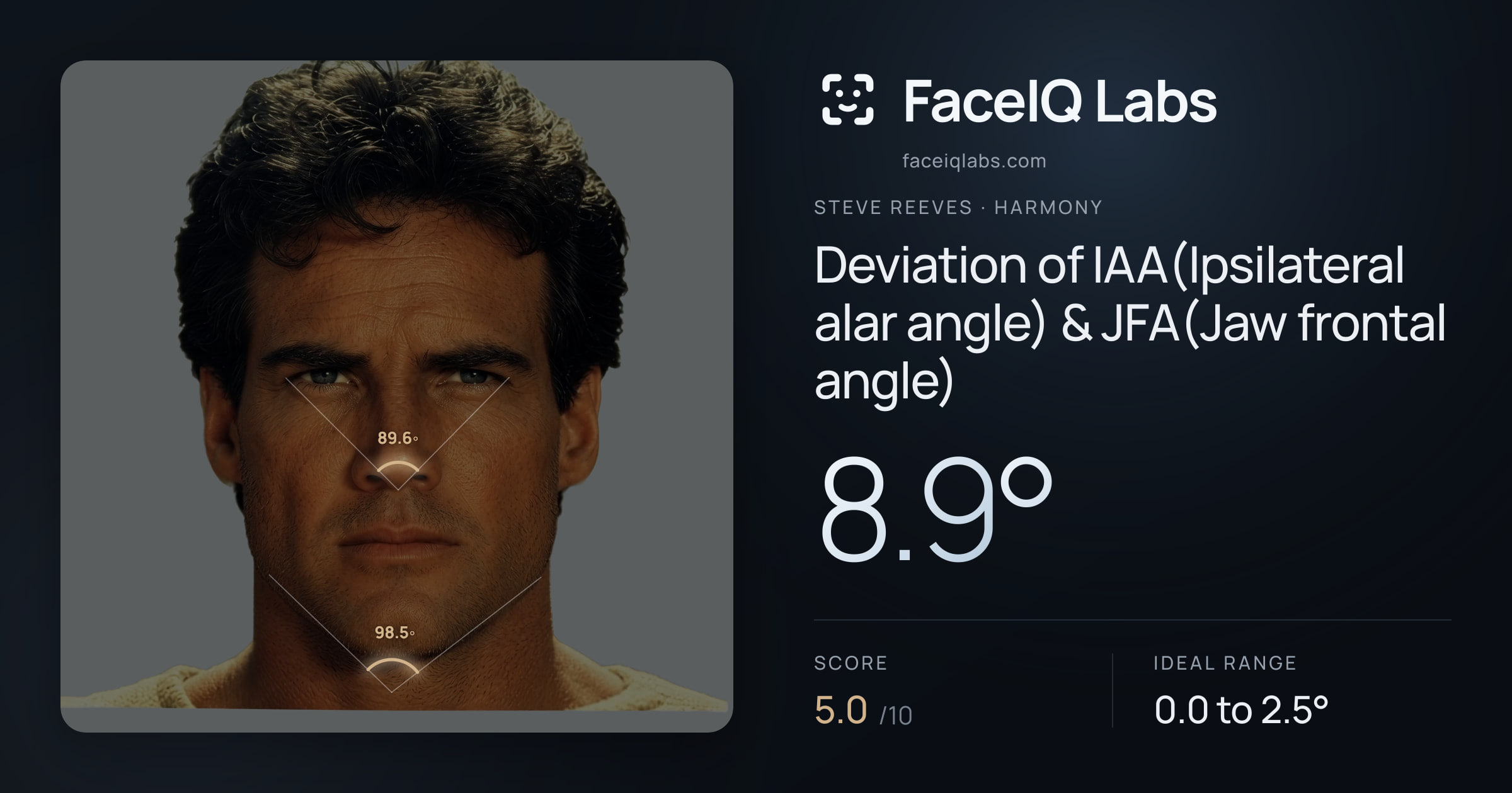 Steve Reeves Deviation of IAA(Ipsilateral alar angle) & JFA(Jaw frontal angle): 8.9°, drawn on the photo