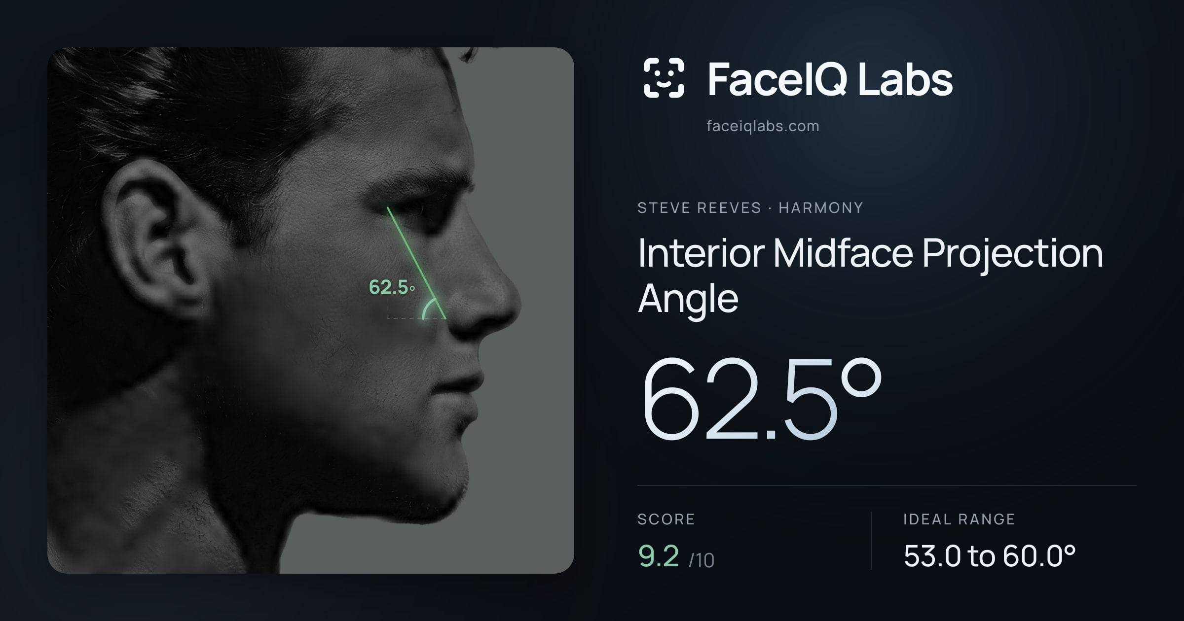Steve Reeves Interior Midface Projection Angle: 62.5°, drawn on the photo