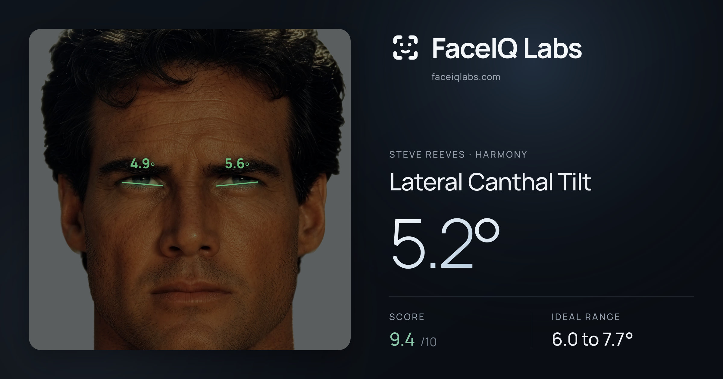 Steve Reeves Lateral Canthal Tilt: 5.2°, drawn on the photo