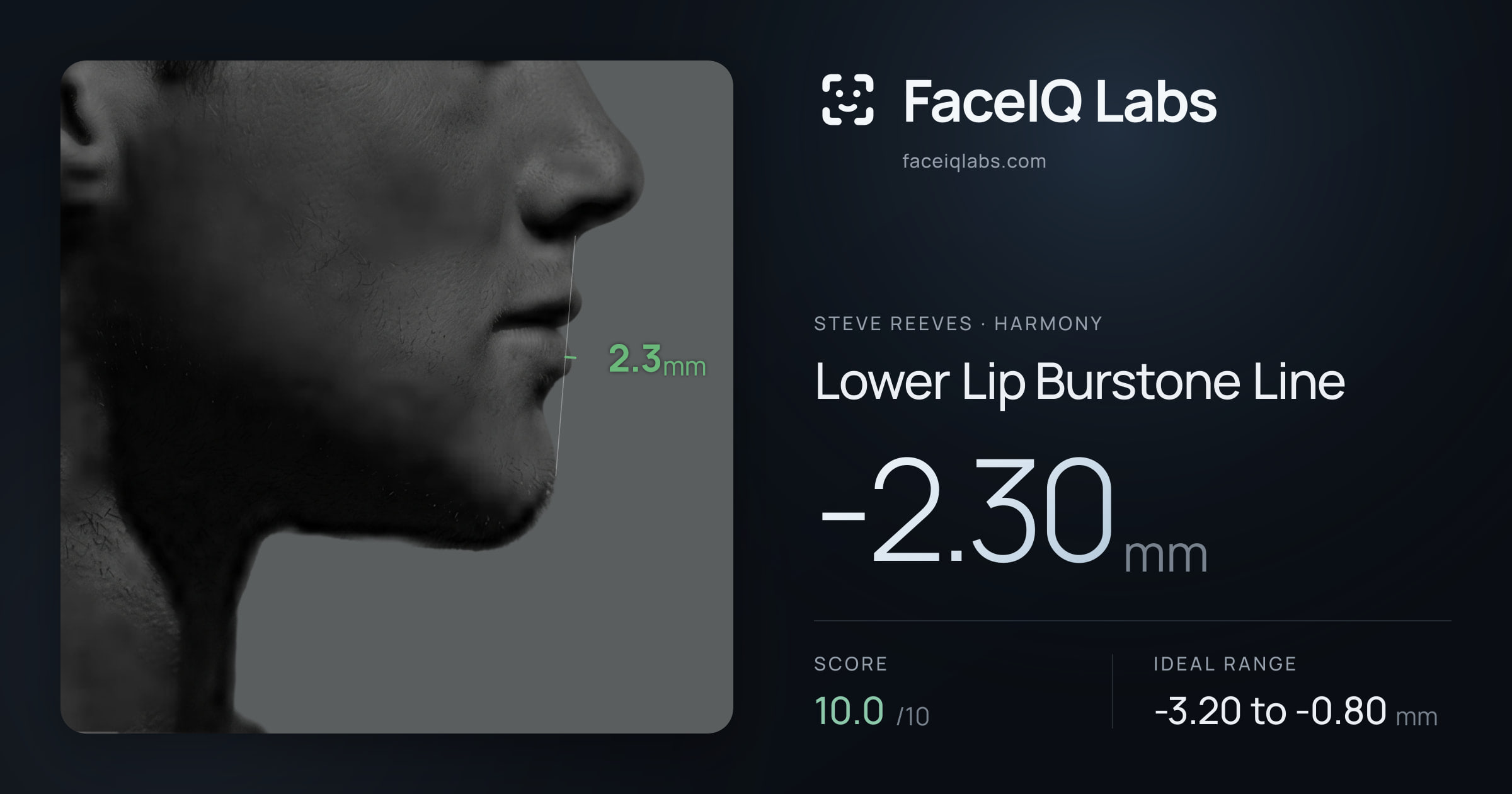 Steve Reeves Lower Lip Burstone Line: -2.30mm, drawn on the photo