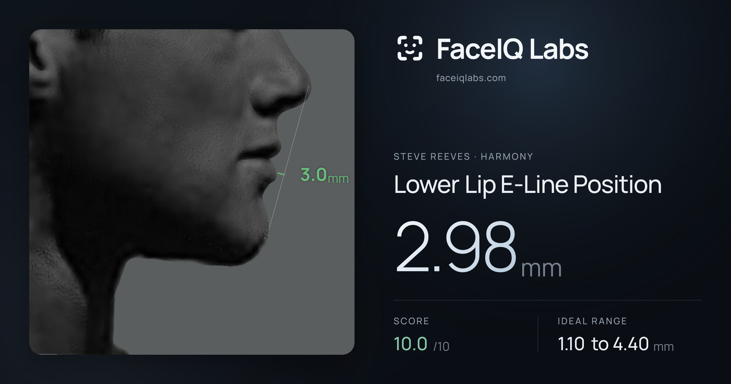 Steve Reeves Lower Lip E-Line Position: 2.98mm, drawn on the photo