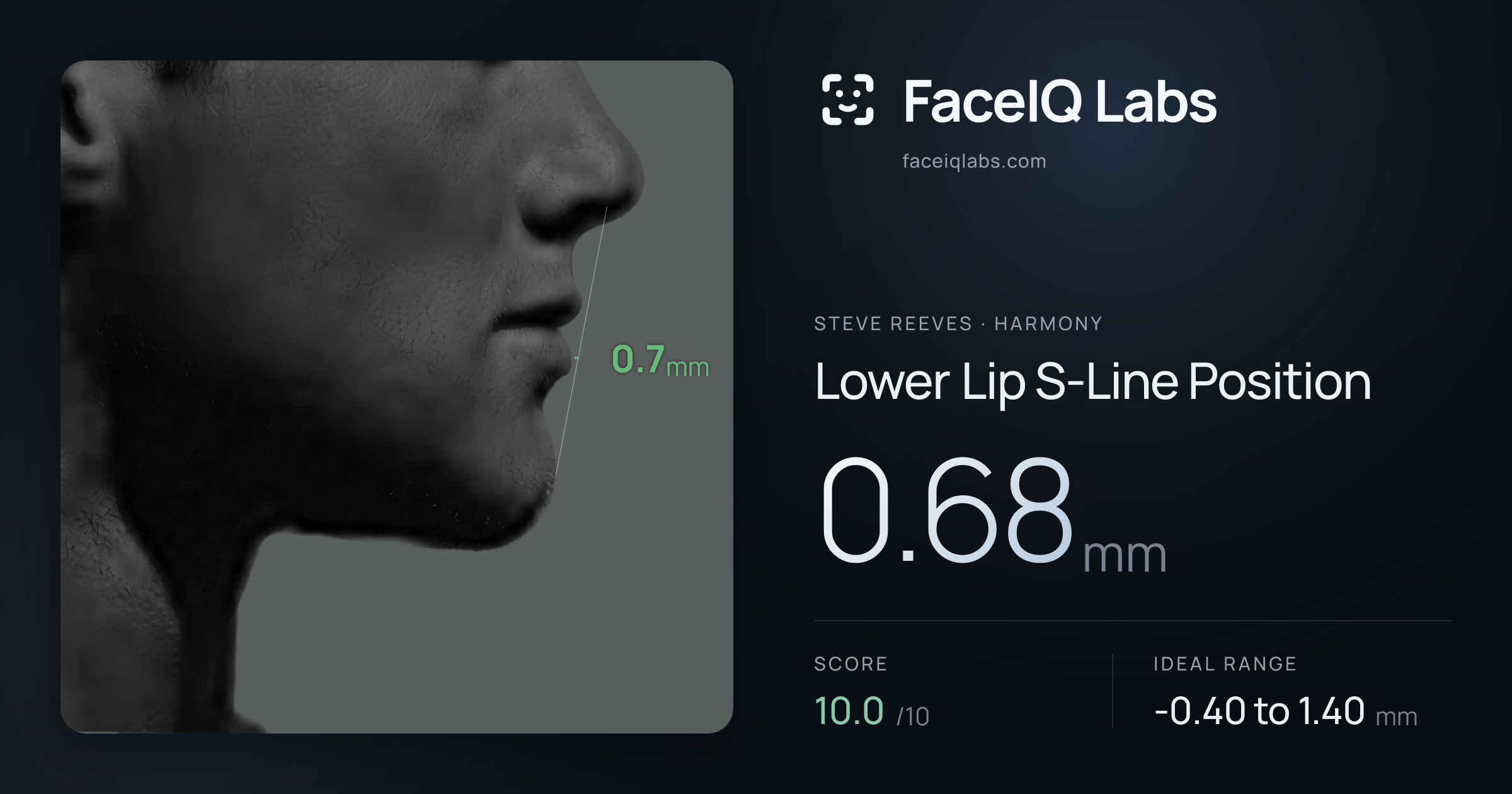 Steve Reeves Lower Lip S-Line Position: 0.68mm, drawn on the photo