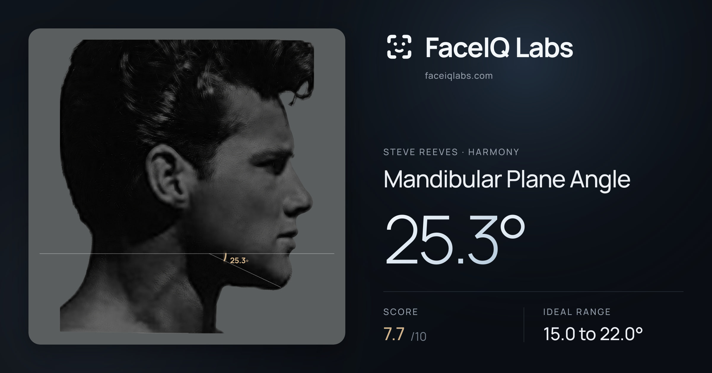 Steve Reeves Mandibular Plane Angle: 25.3°, drawn on the photo