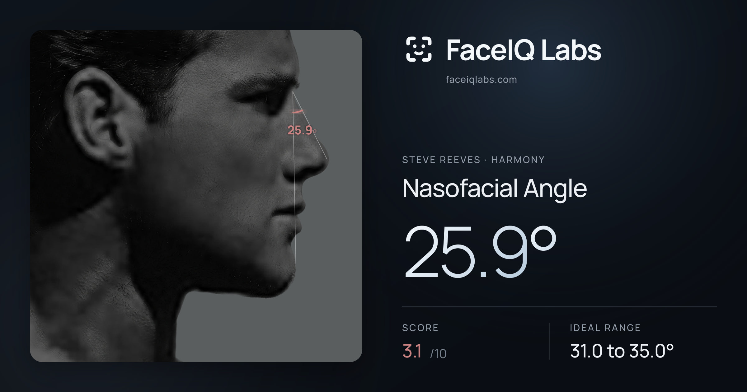 Steve Reeves Nasofacial Angle: 25.9°, drawn on the photo
