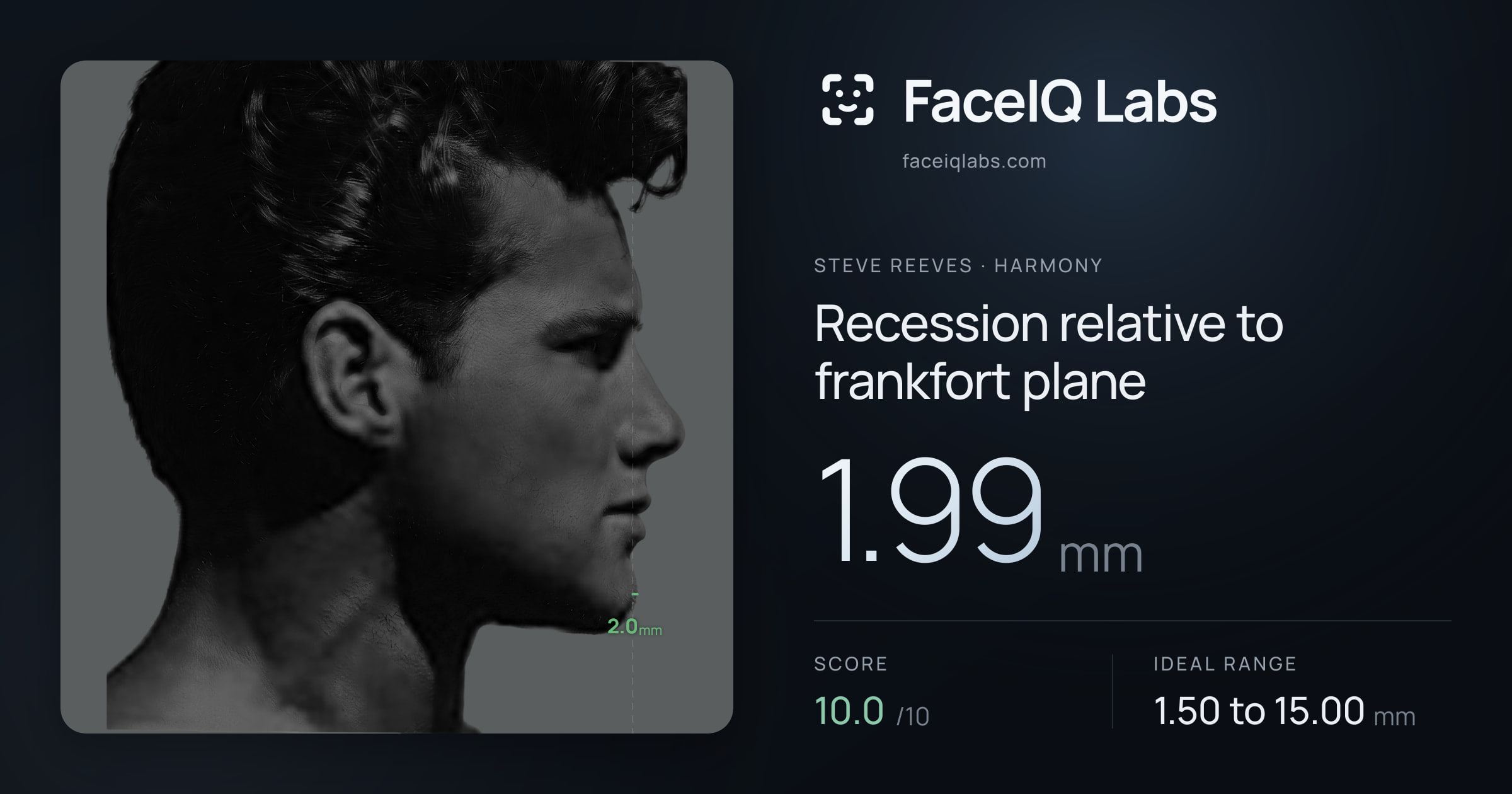 Steve Reeves Recession relative to frankfort plane: 1.99mm, drawn on the photo