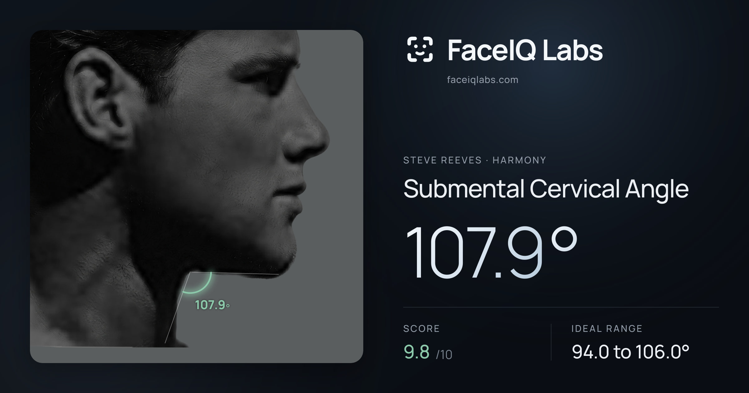 Steve Reeves Submental Cervical Angle: 107.9°, drawn on the photo