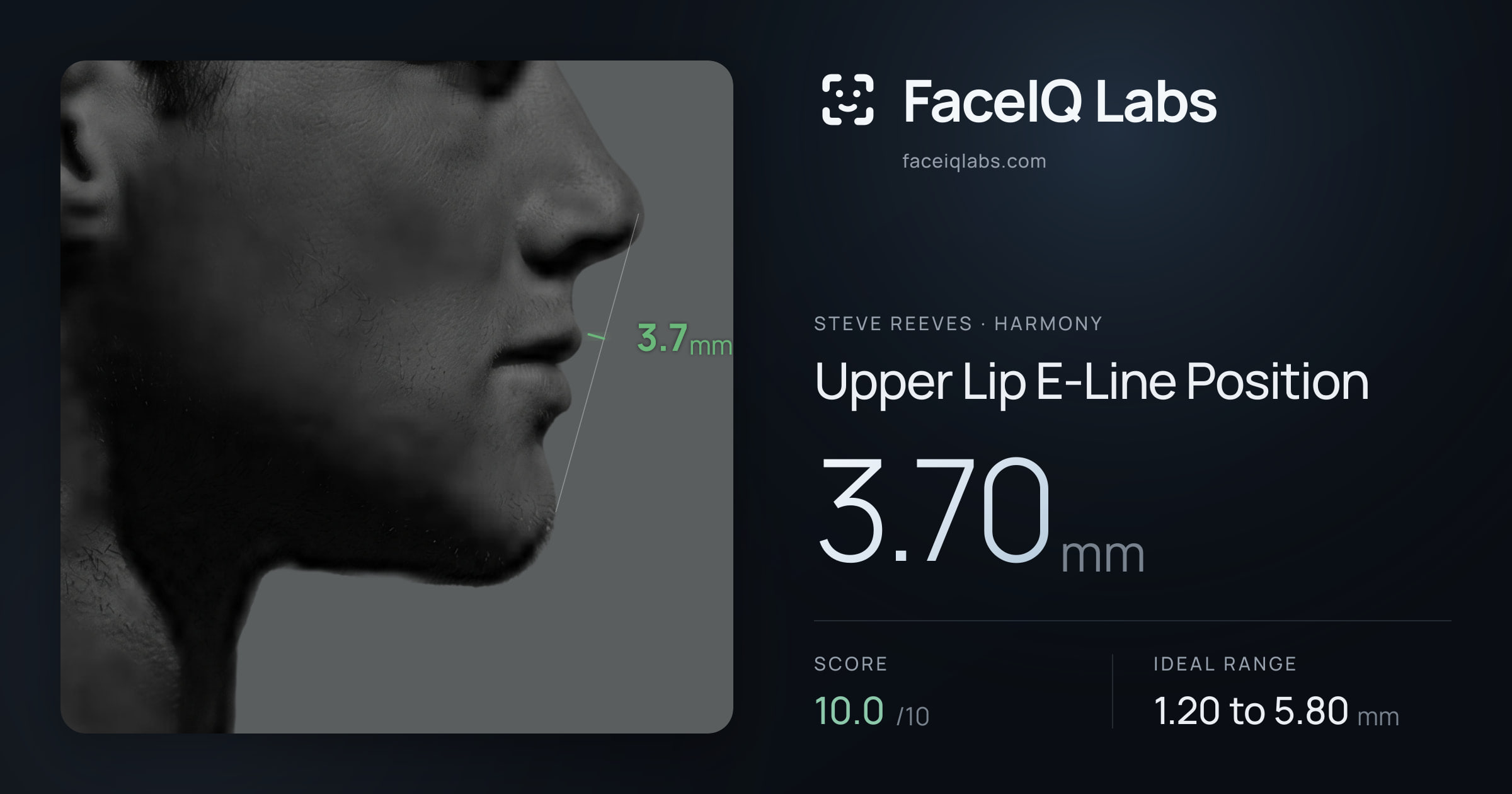 Steve Reeves Upper Lip E-Line Position: 3.70mm, drawn on the photo