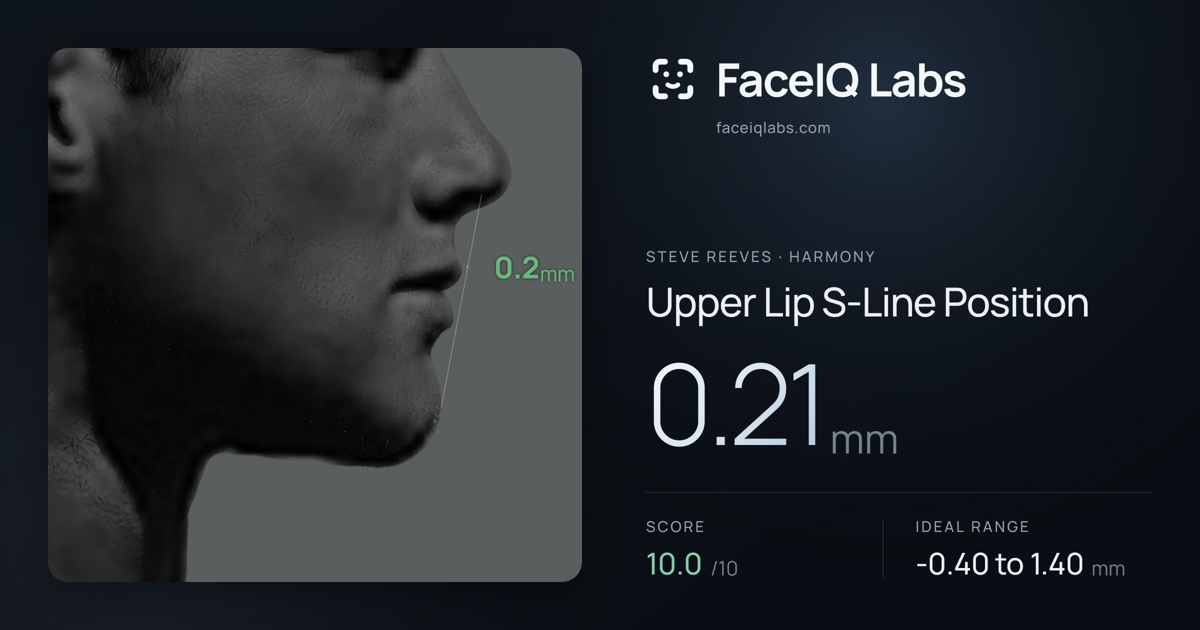 Steve Reeves Upper Lip S-Line Position: 0.21mm, drawn on the photo