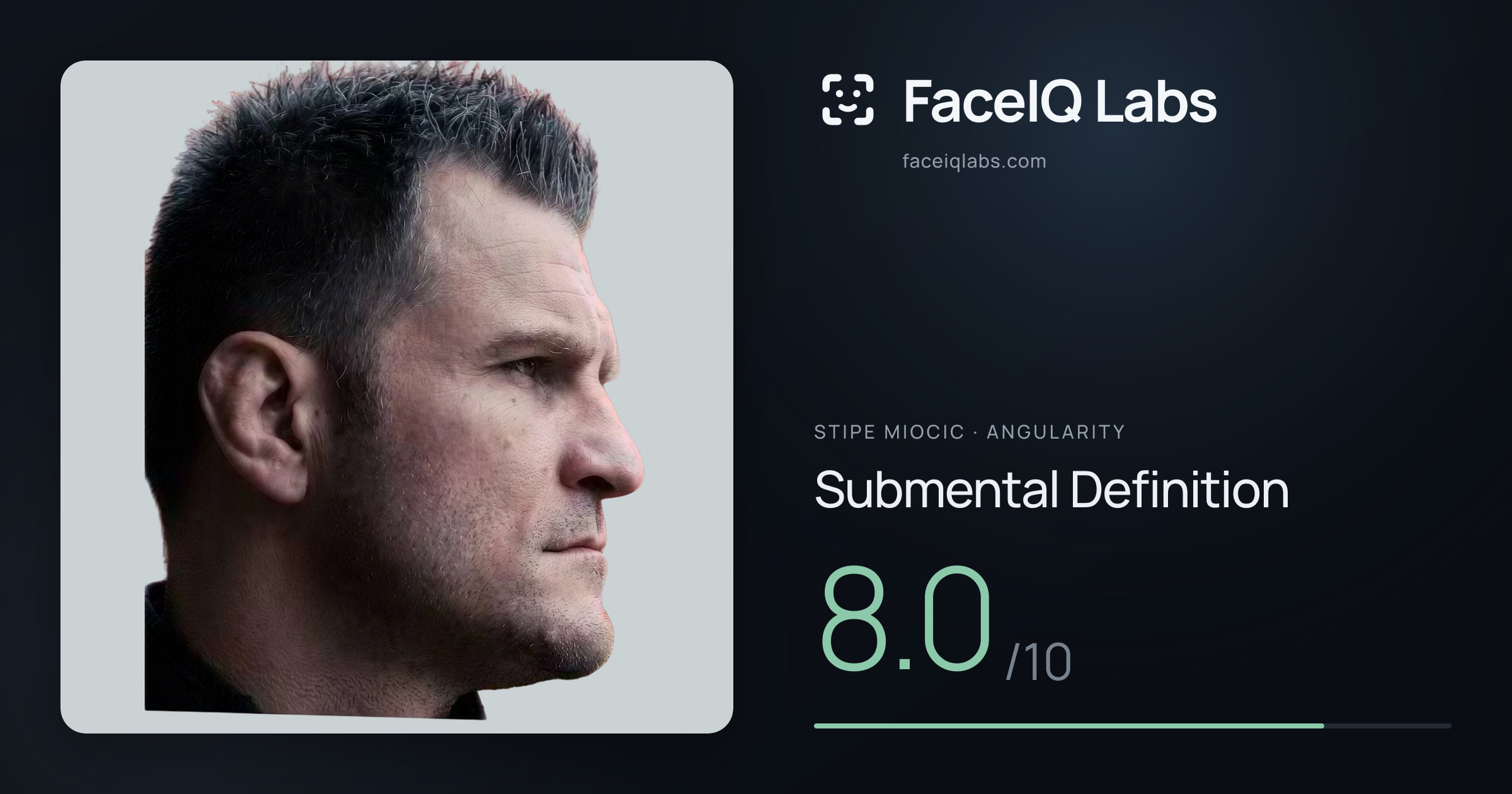 Stipe Miocic Submental Definition: 8.0/10, drawn on the photo
