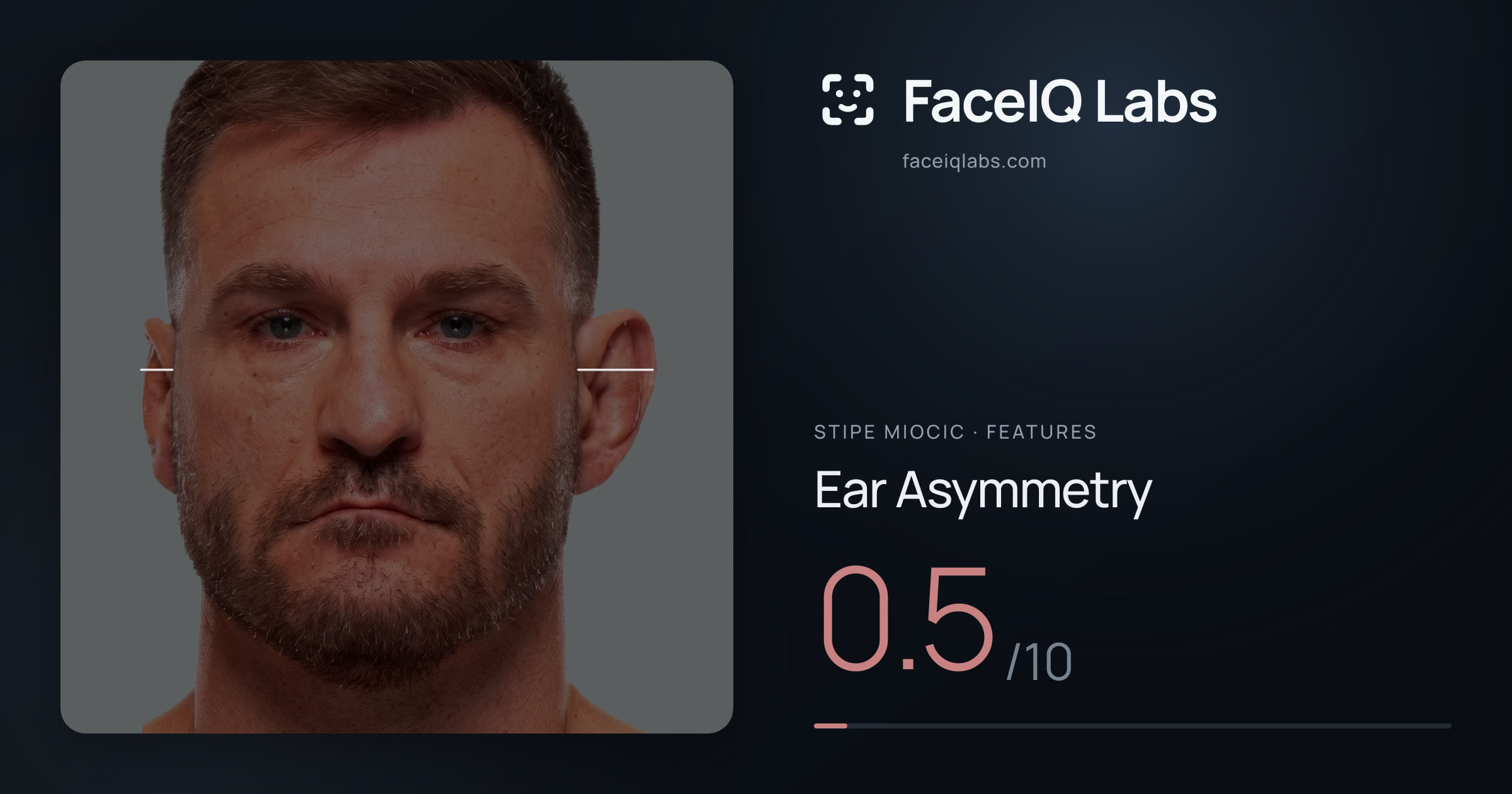 Stipe Miocic Ear Asymmetry: 0.5/10, drawn on the photo