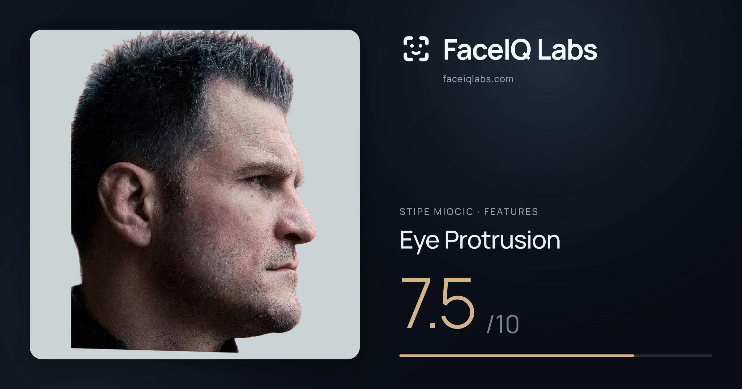 Stipe Miocic Eye Protrusion: 7.5/10, drawn on the photo