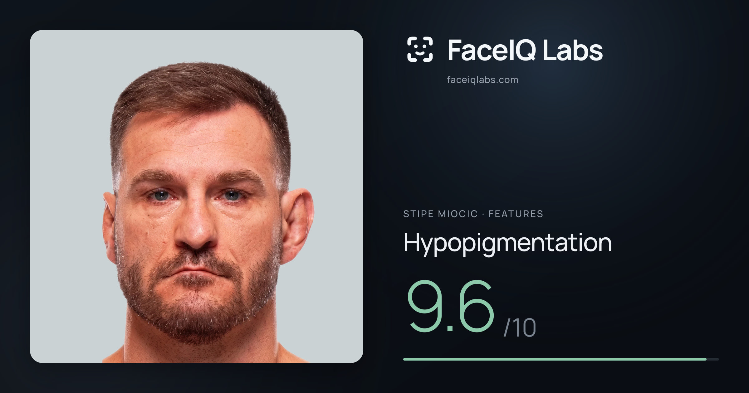 Stipe Miocic Hypopigmentation: 9.6/10, drawn on the photo