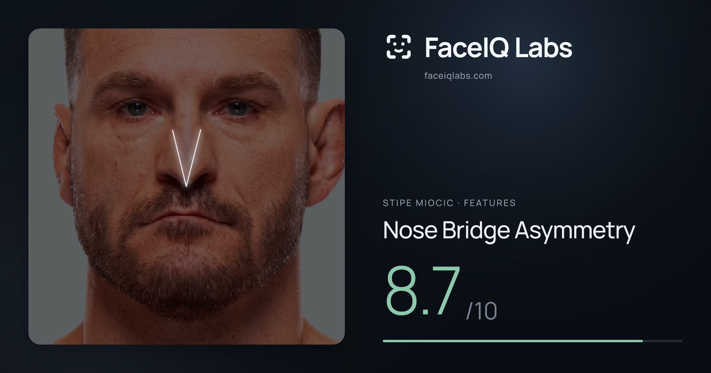 Stipe Miocic Nose Bridge Asymmetry: 8.7/10, drawn on the photo