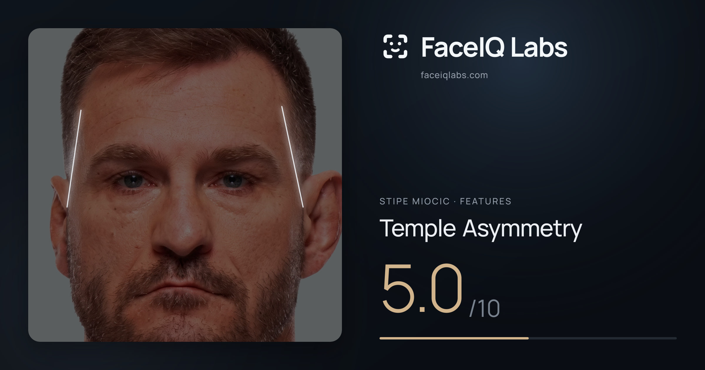 Stipe Miocic Temple Asymmetry: 5.0/10, drawn on the photo