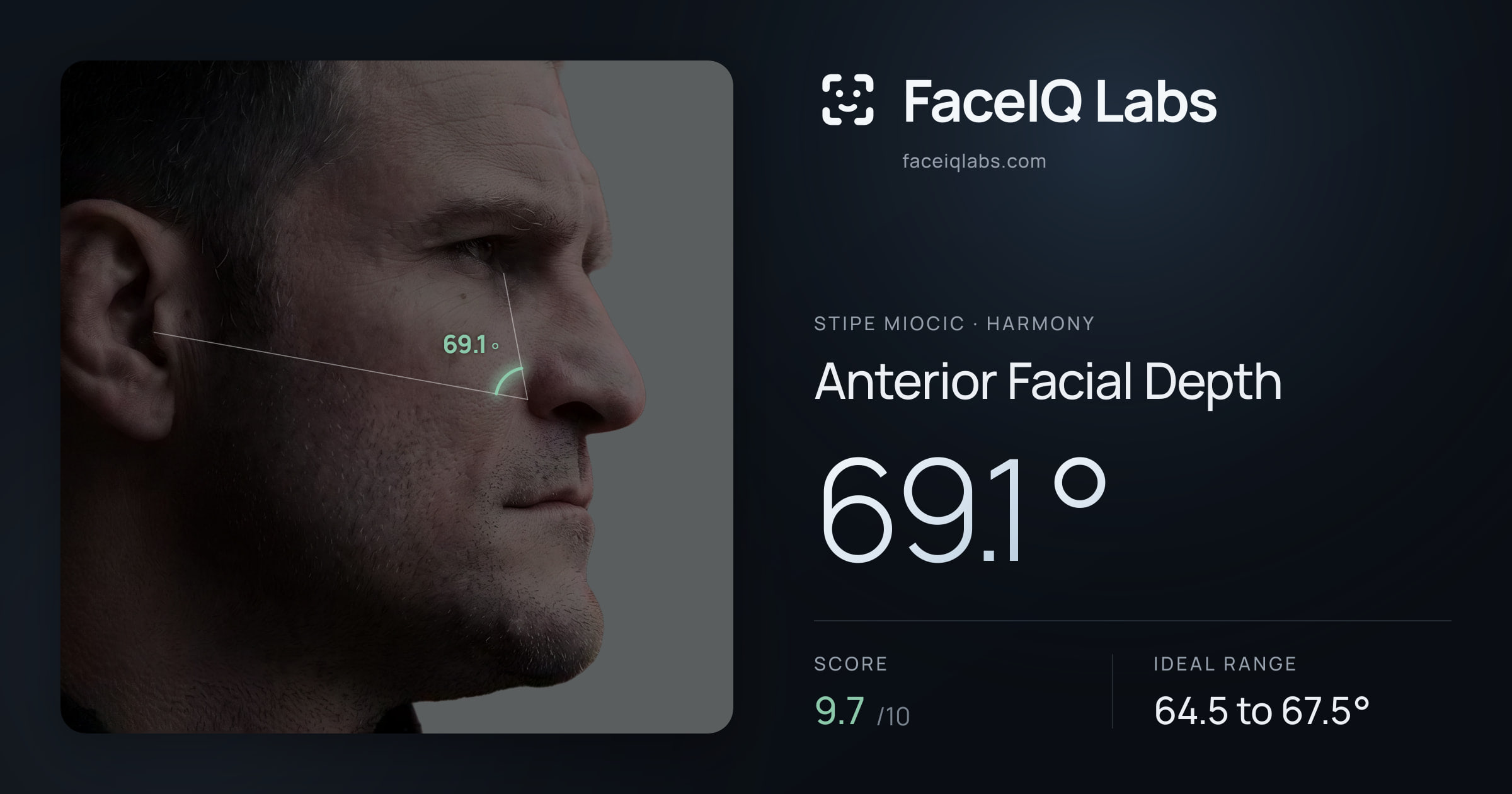 Stipe Miocic Anterior Facial Depth: 69.1°, drawn on the photo
