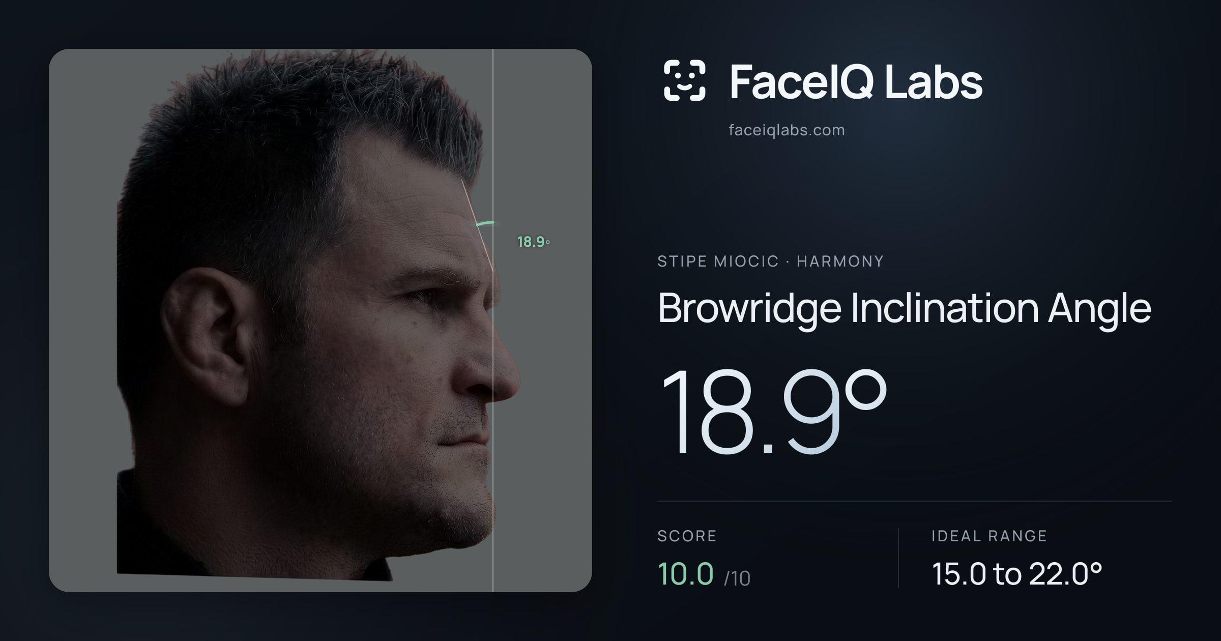 Stipe Miocic Browridge Inclination Angle: 18.9°, drawn on the photo