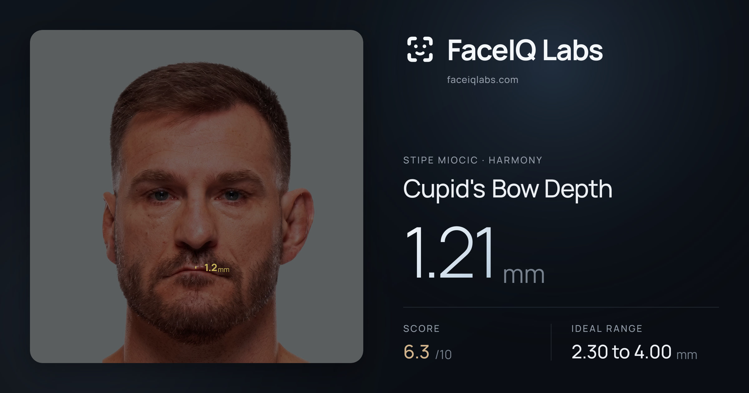 Stipe Miocic Cupid's Bow Depth: 1.21mm, drawn on the photo
