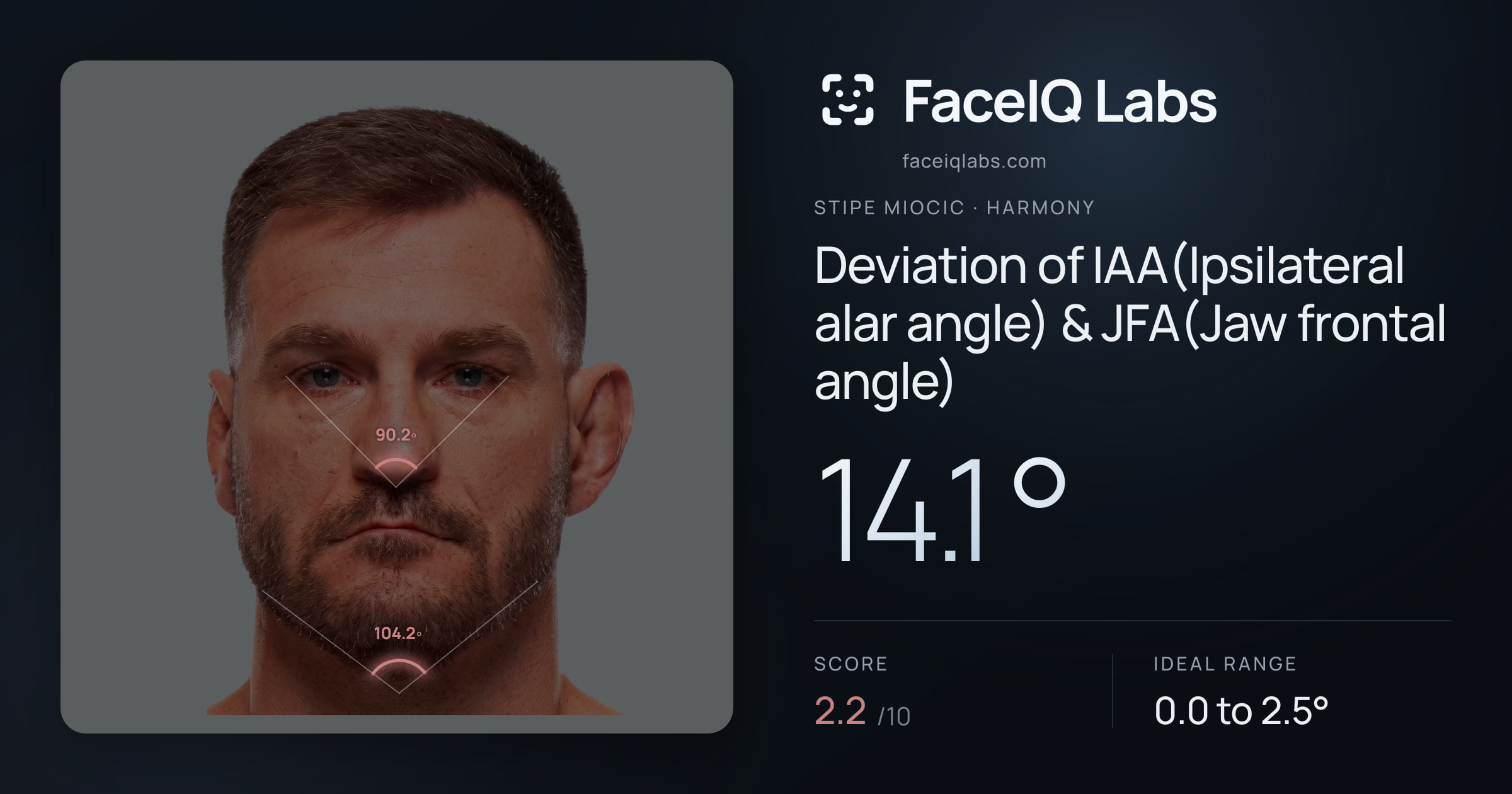 Stipe Miocic Deviation of IAA(Ipsilateral alar angle) & JFA(Jaw frontal angle): 14.1°, drawn on the photo