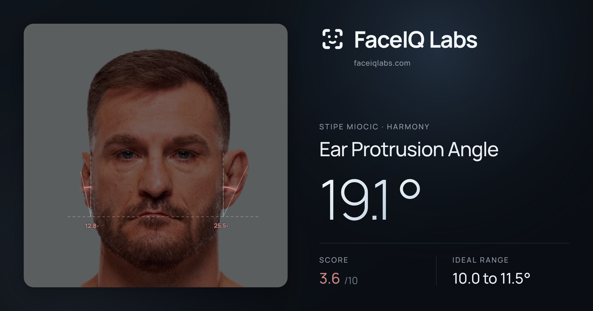 Stipe Miocic Ear Protrusion Angle: 19.1°, drawn on the photo