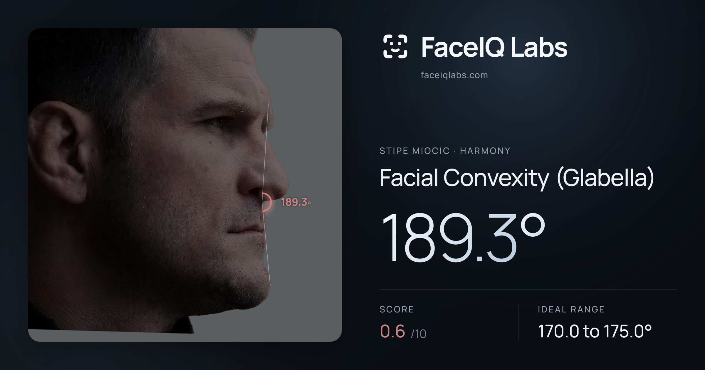 Stipe Miocic Facial Convexity (Glabella): 189.3°, drawn on the photo