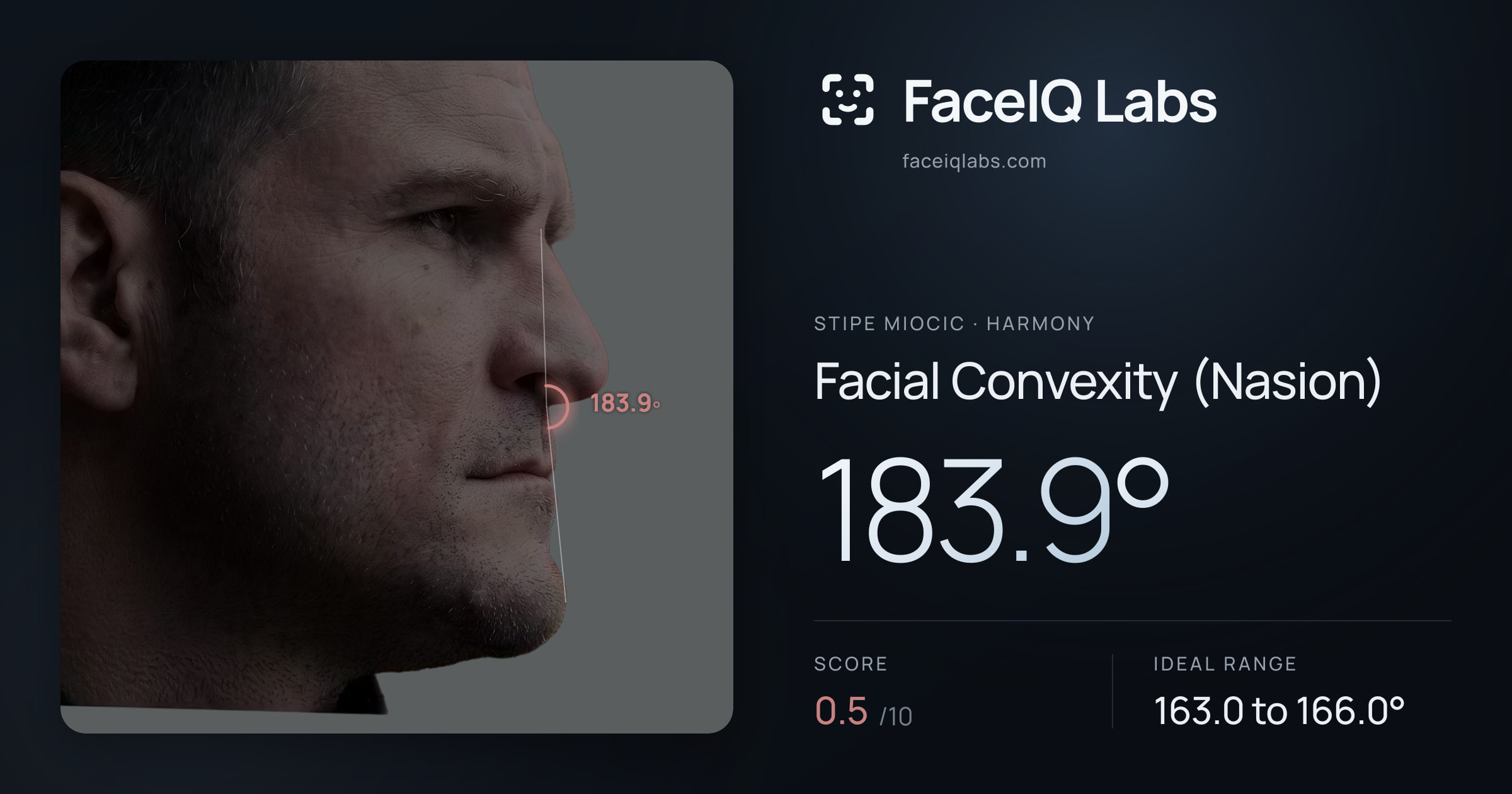Stipe Miocic Facial Convexity (Nasion): 183.9°, drawn on the photo