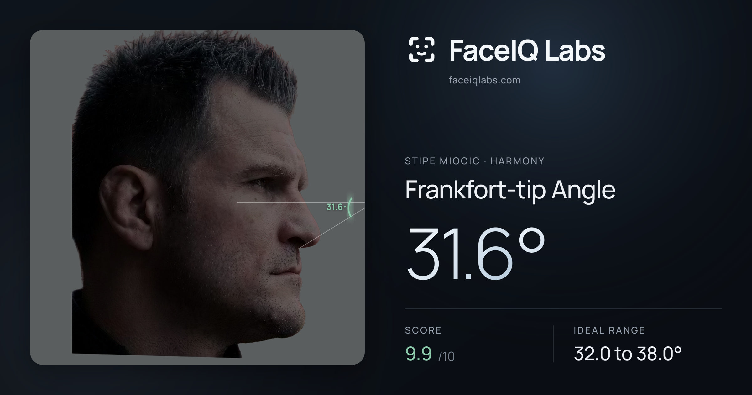 Stipe Miocic Frankfort-tip Angle: 31.6°, drawn on the photo