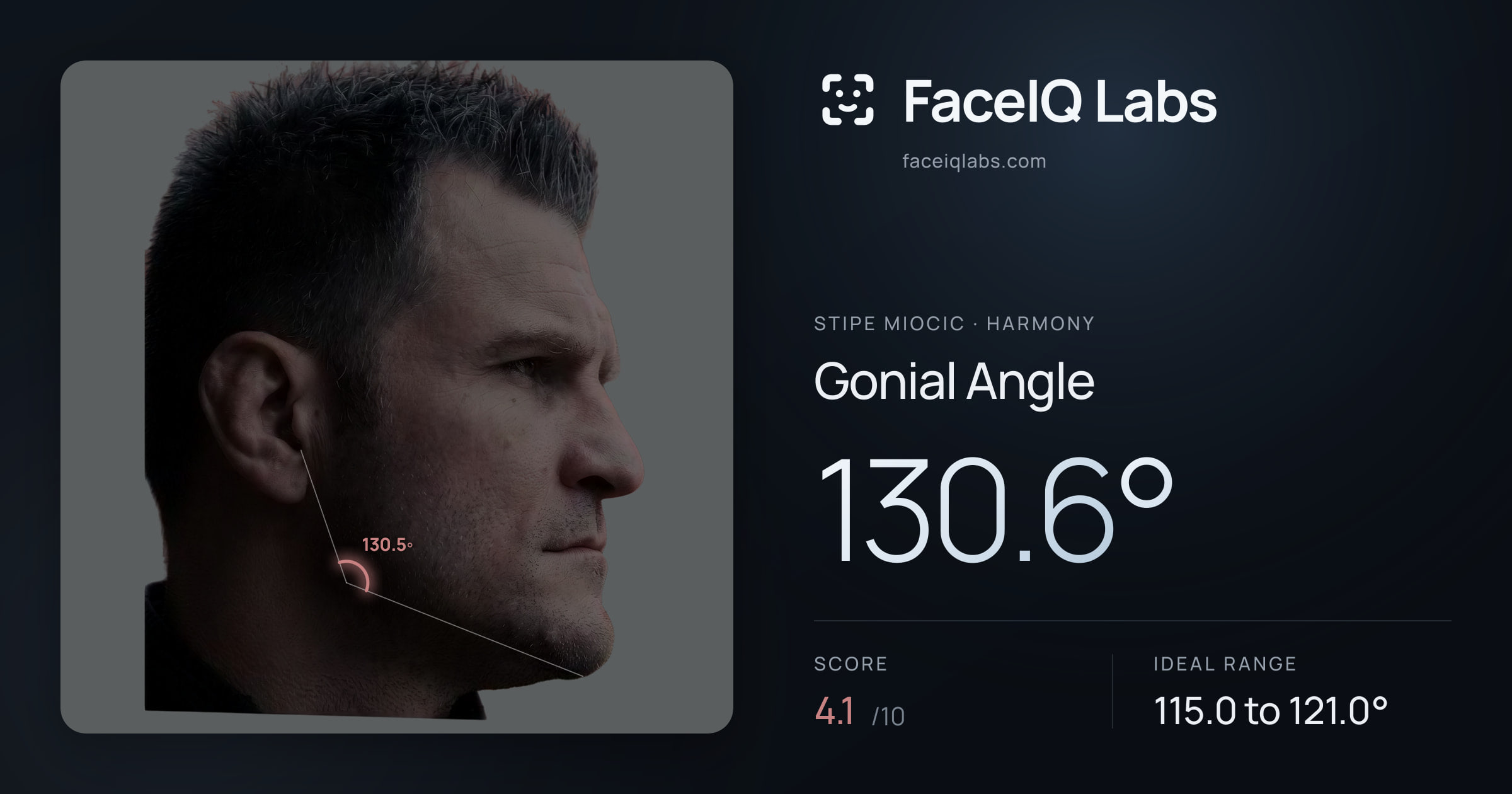 Stipe Miocic Gonial Angle: 130.6°, drawn on the photo