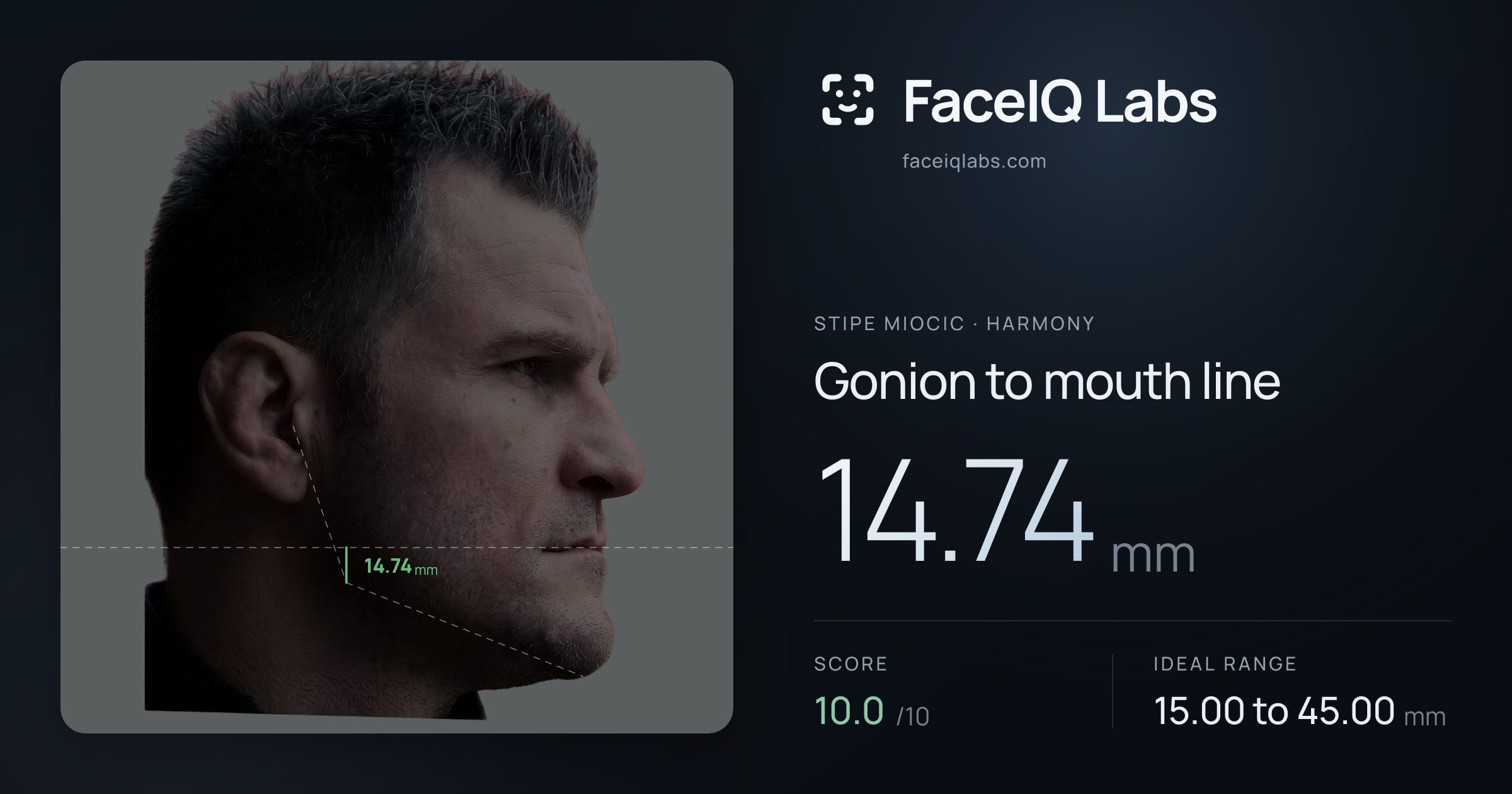 Stipe Miocic Gonion to mouth line: 14.74mm, drawn on the photo