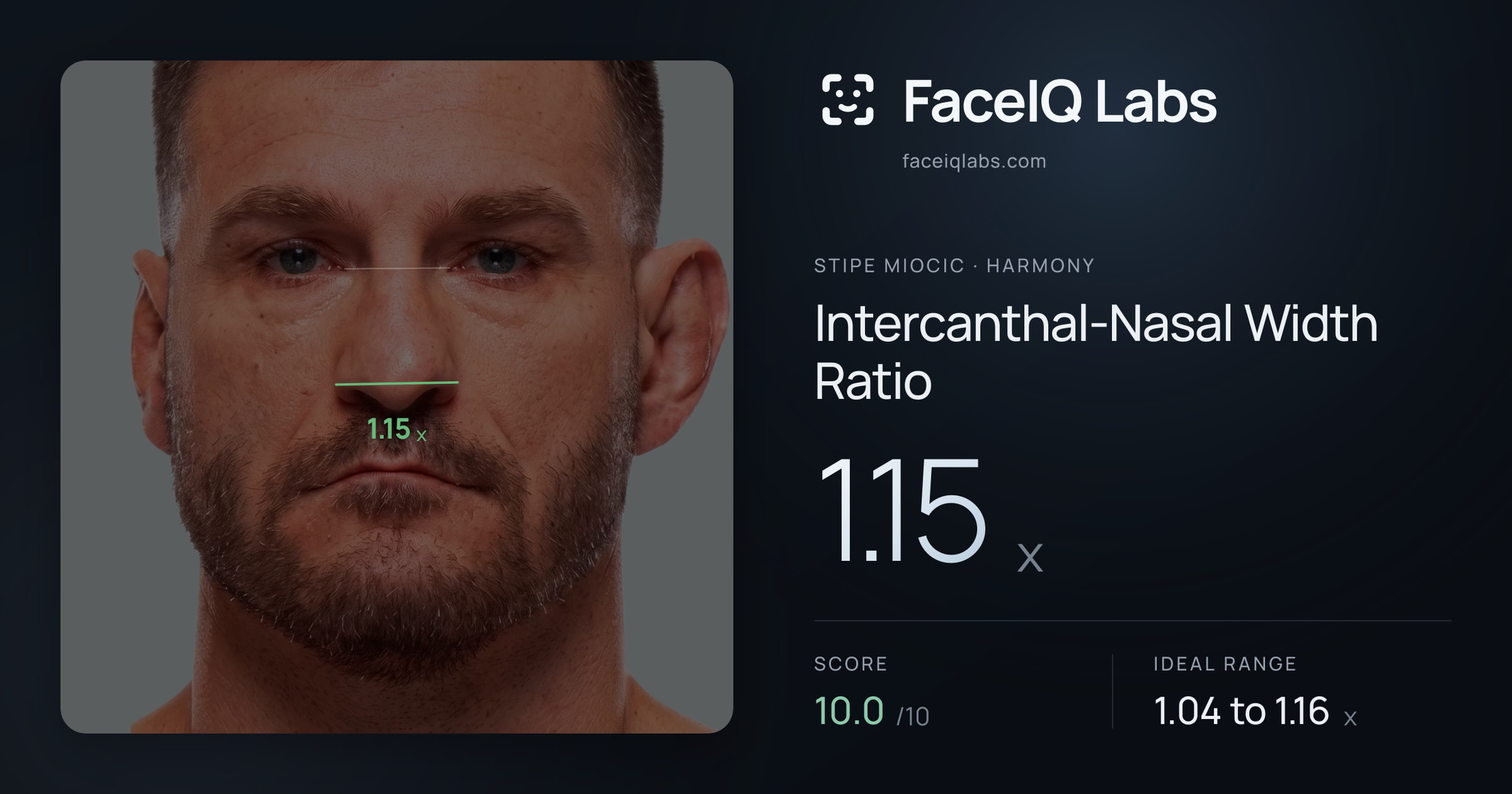 Stipe Miocic Intercanthal-Nasal Width Ratio: 1.15x, drawn on the photo