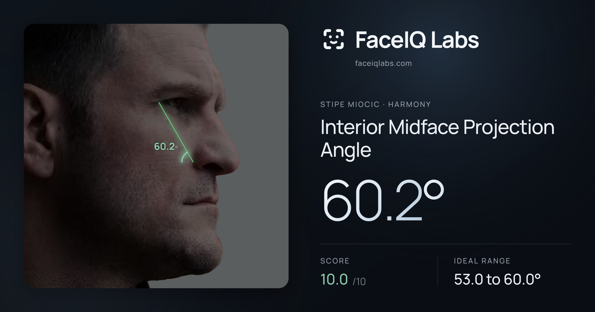 Stipe Miocic Interior Midface Projection Angle: 60.2°, drawn on the photo