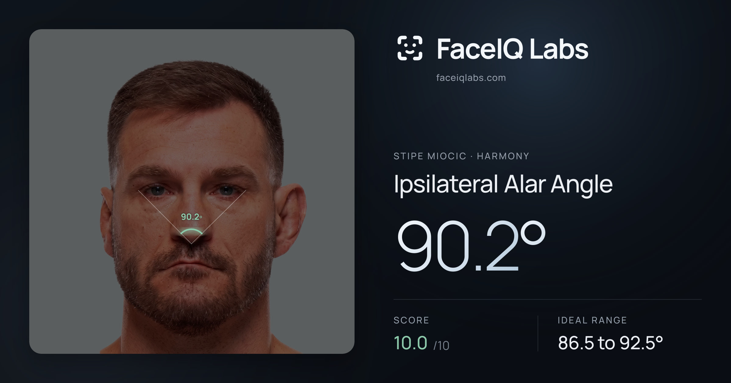 Stipe Miocic Ipsilateral Alar Angle: 90.2°, drawn on the photo