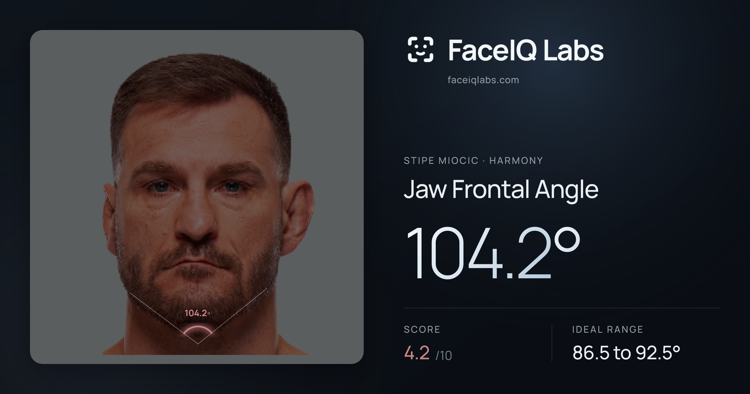 Stipe Miocic Jaw Frontal Angle: 104.2°, drawn on the photo