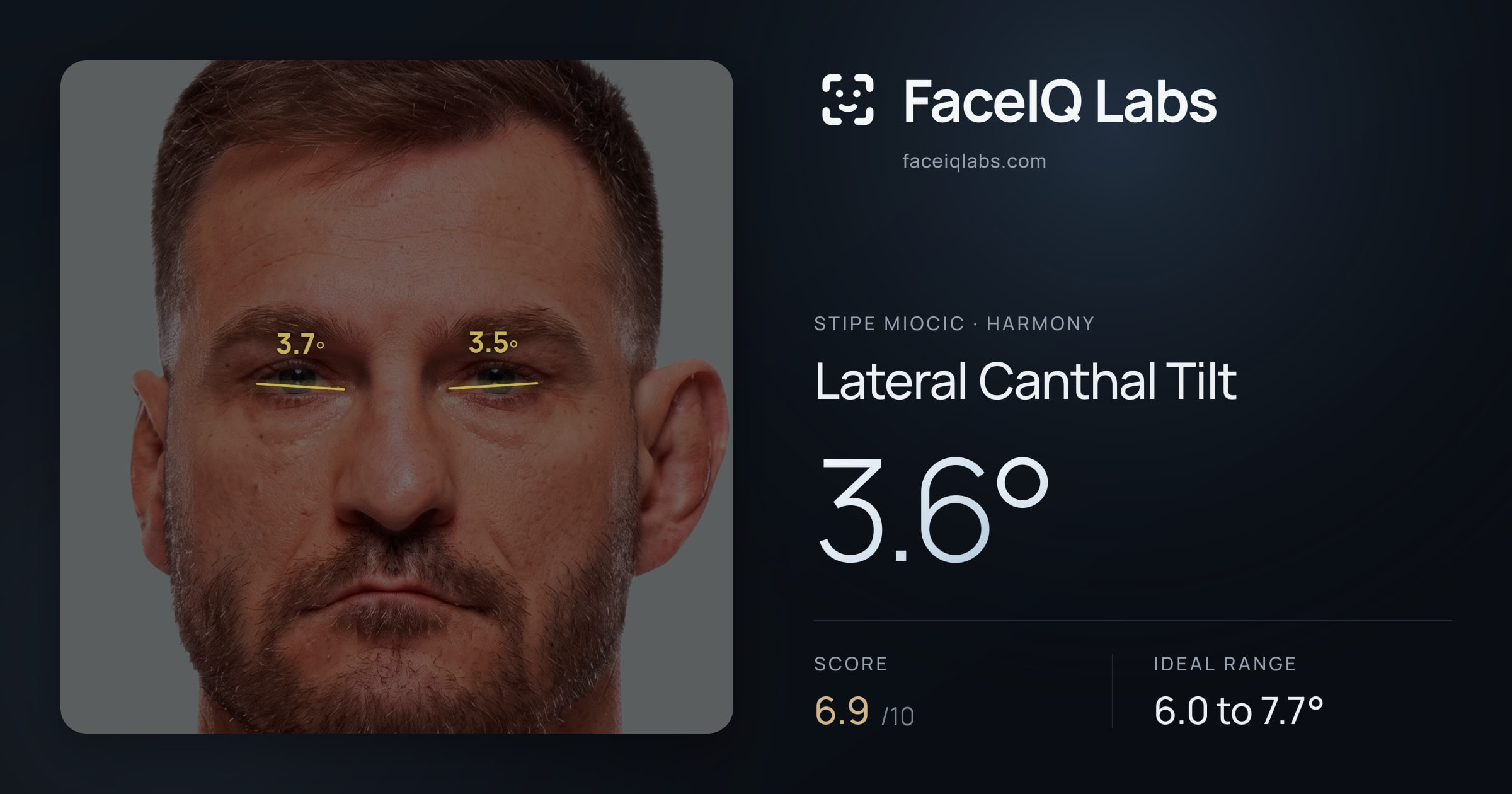 Stipe Miocic Lateral Canthal Tilt: 3.6°, drawn on the photo